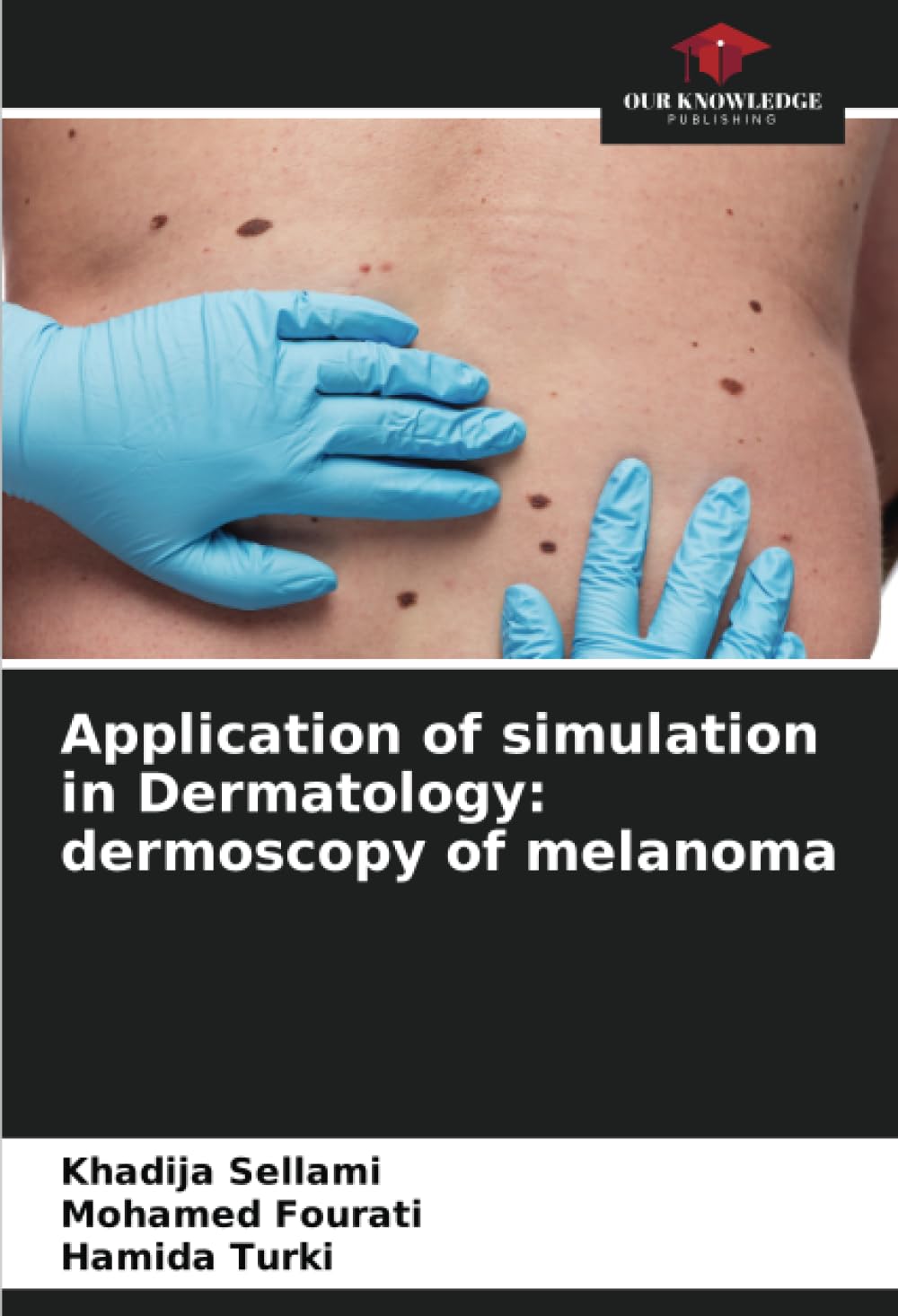 Application of simulation in Dermatology: dermoscopy of melanoma Medicine