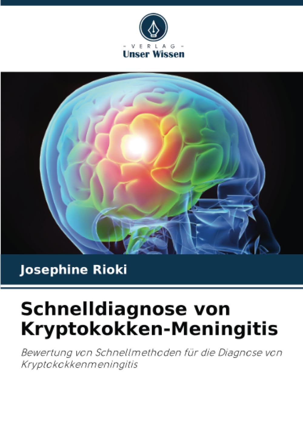 Schnelldiagnose von Kryptokokken-Meningitis: Bewertung von Schnellmethoden für die Diagnose von Kryptokokkenmeningitis Medicine