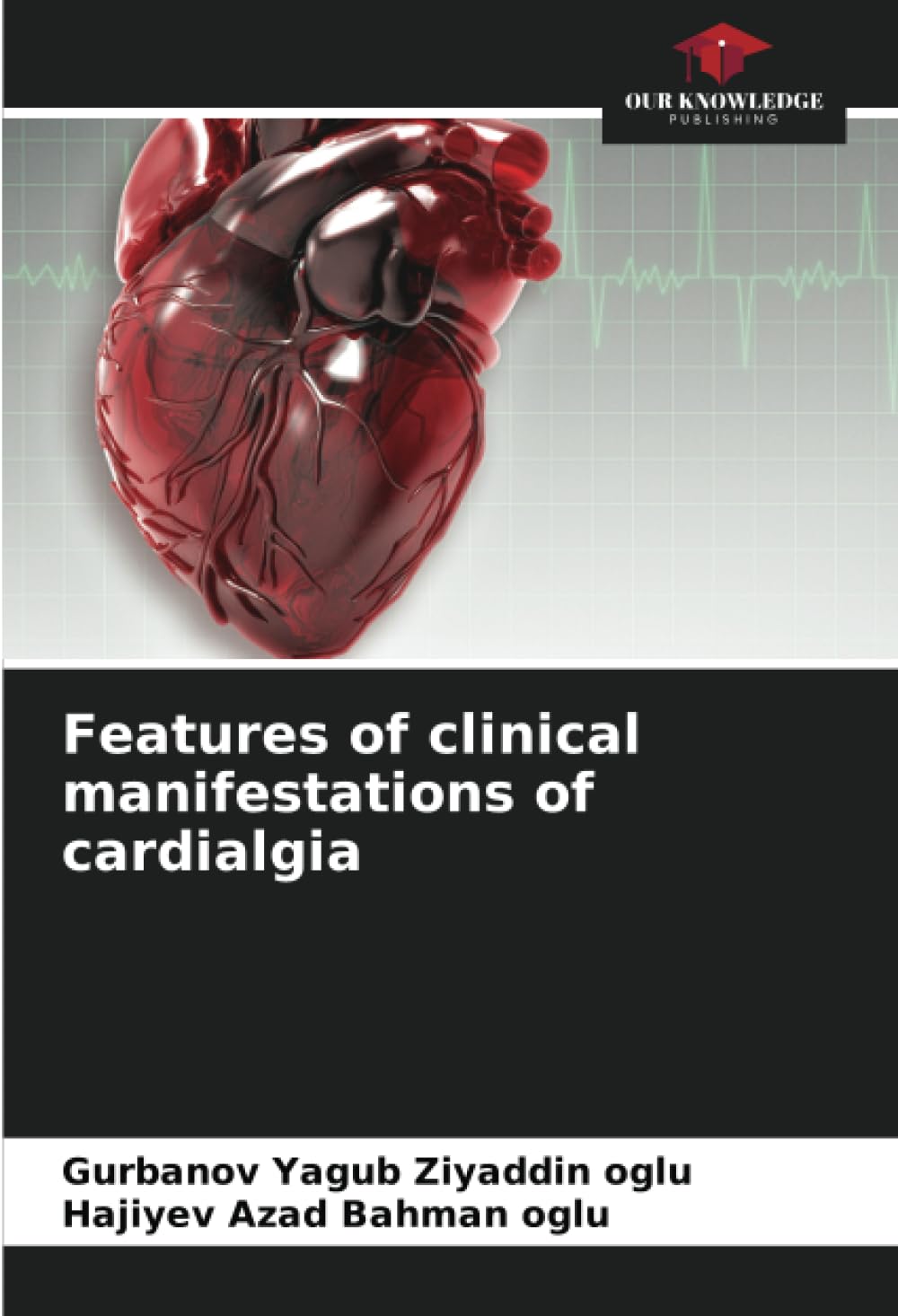Features of clinical manifestations of cardialgia Medicine