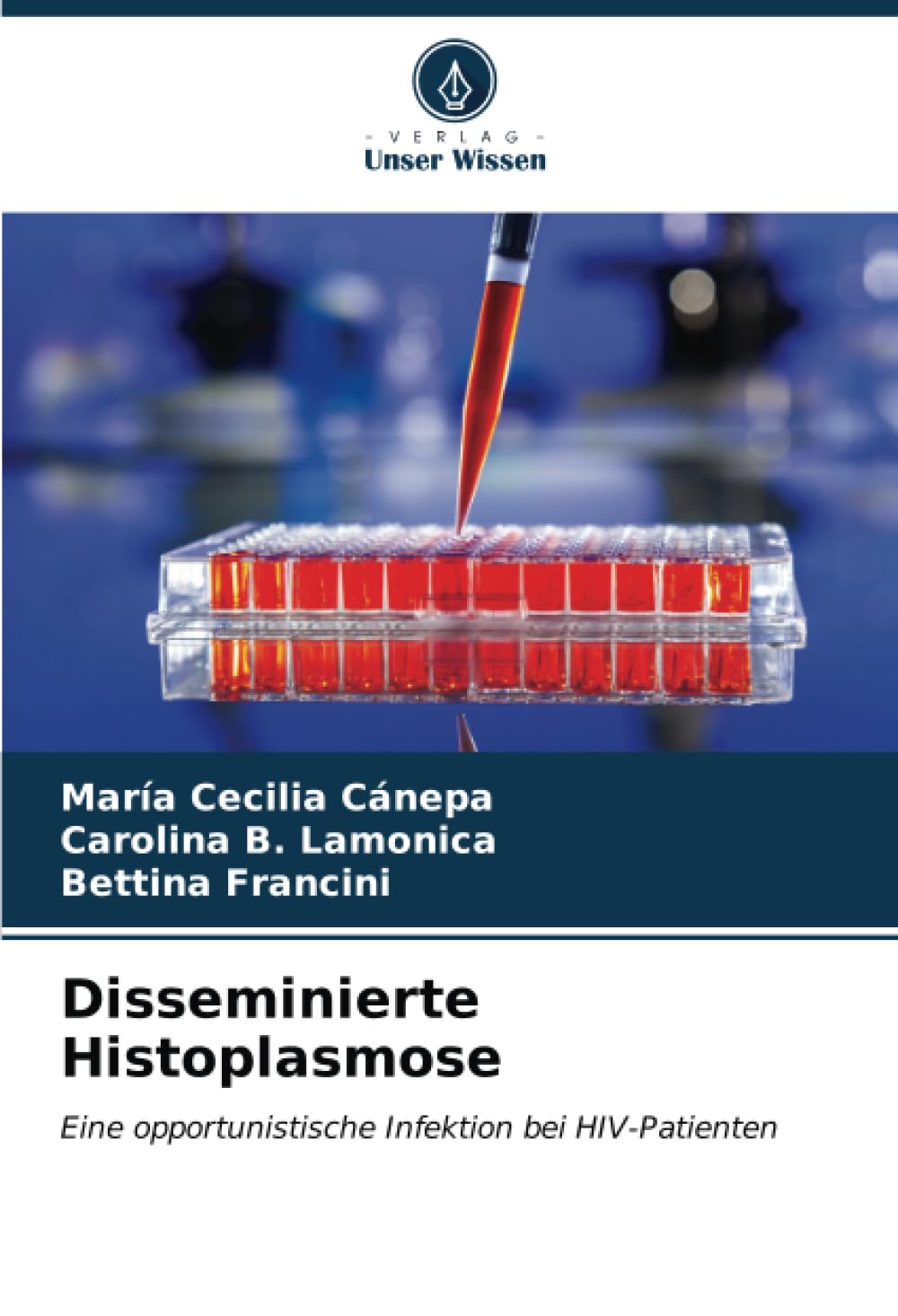Disseminierte Histoplasmose: Eine opportunistische Infektion bei HIV-Patienten book