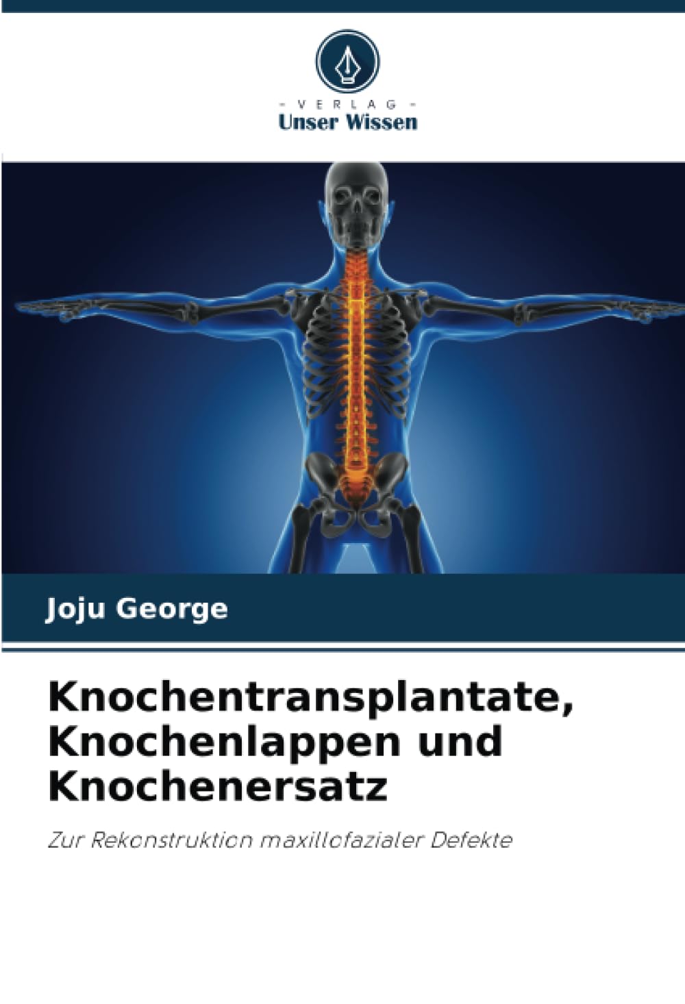 Knochentransplantate, Knochenlappen und Knochenersatz: Zur Rekonstruktion maxillofazialer Defekte Medicine