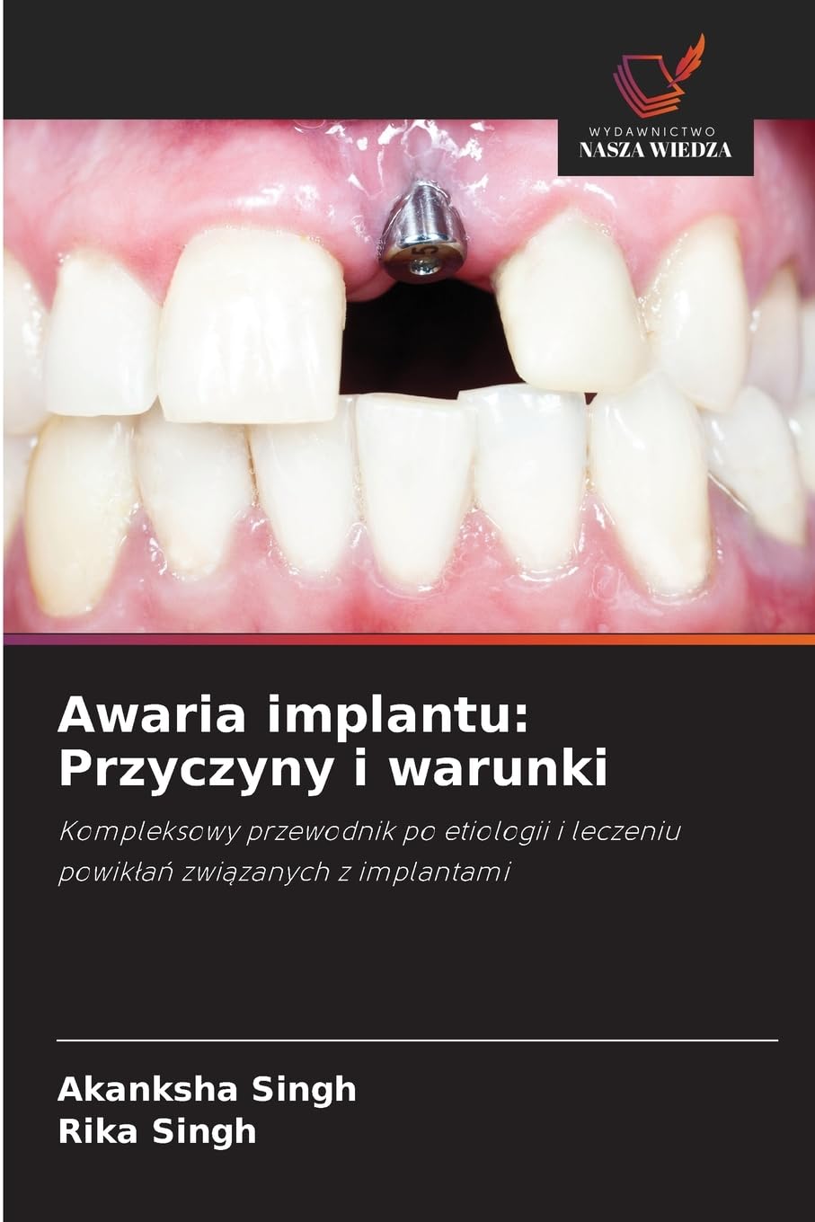 Awaria implantu: Przyczyny i warunki Medicine