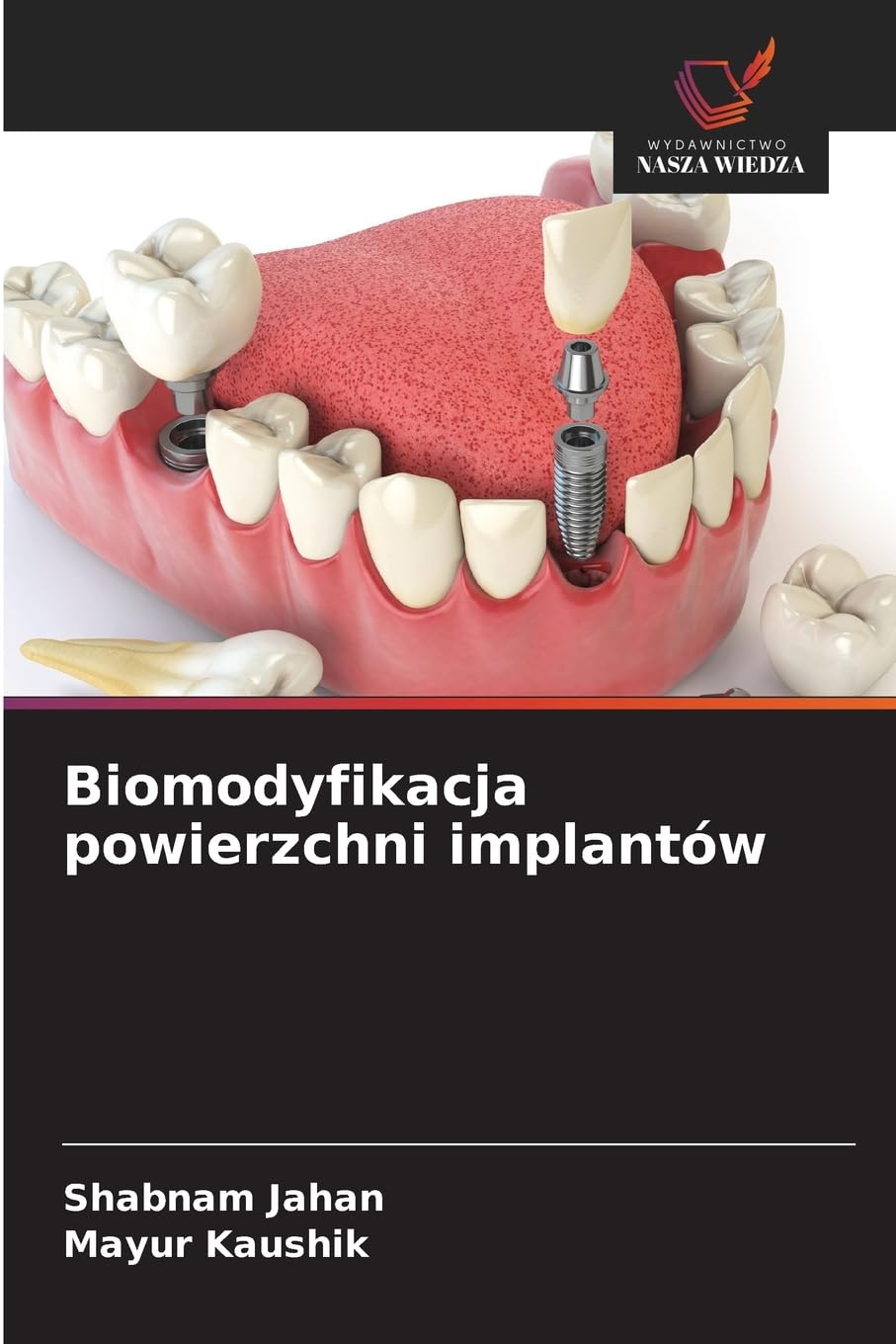 Biomodyfikacja powierzchni implantów Medicine