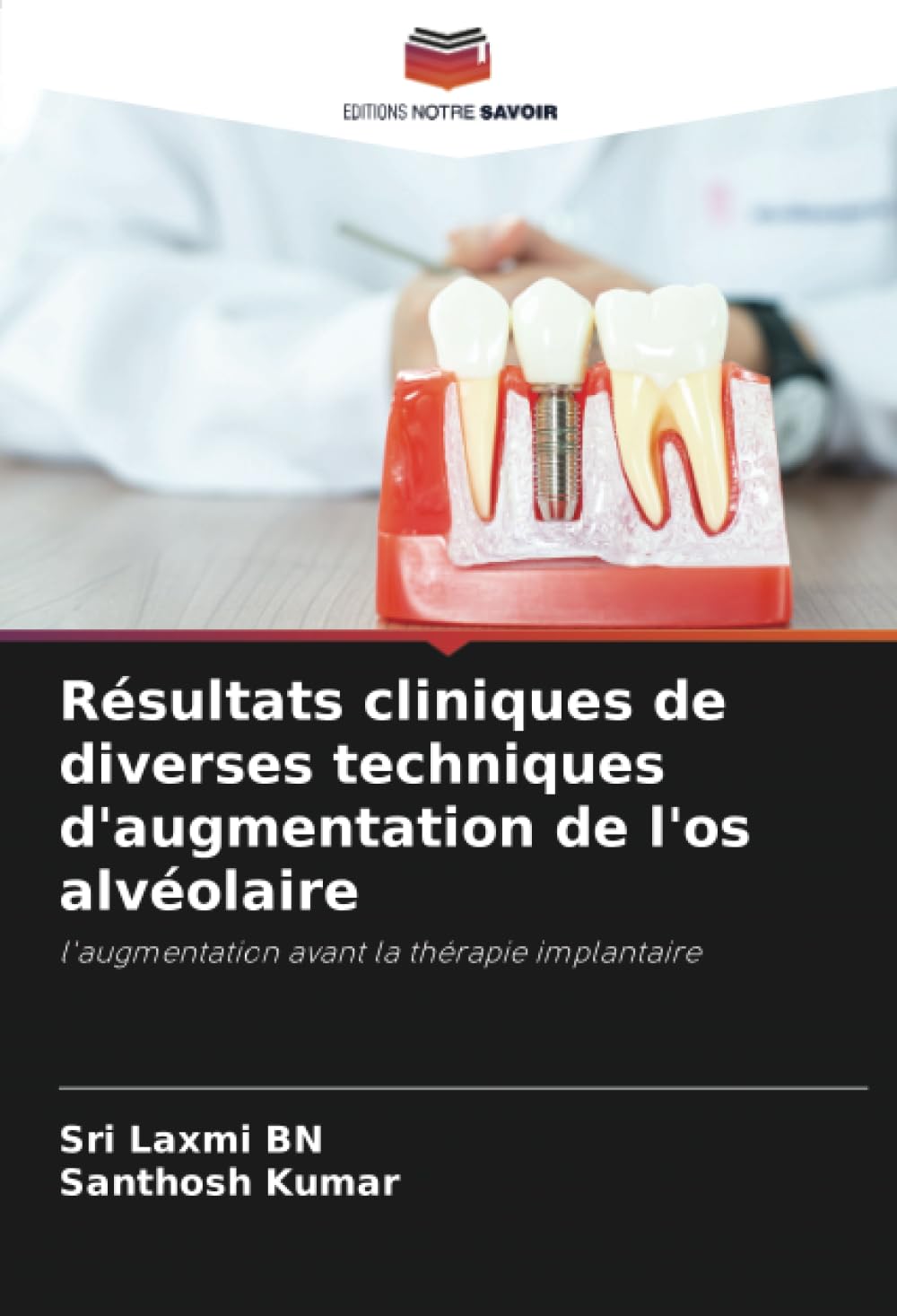 Résultats cliniques de diverses techniques d'augmentation de l'os alvéolaire: l'augmentation avant la thérapie implantaire book