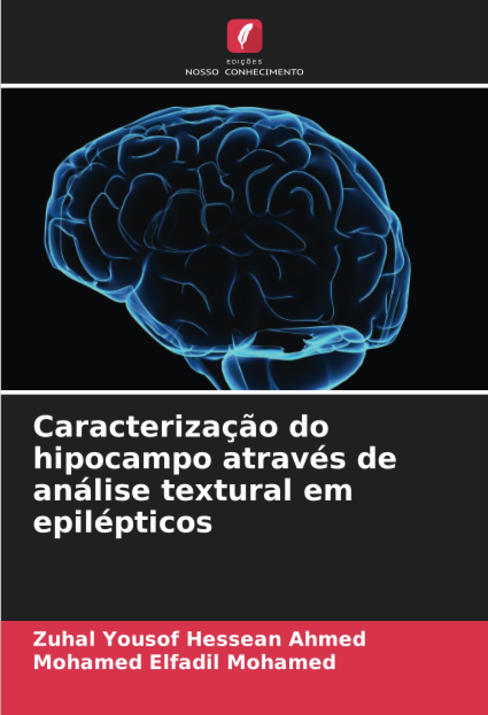 Caracterização do hipocampo através de análise textural em epilépticos Medicine