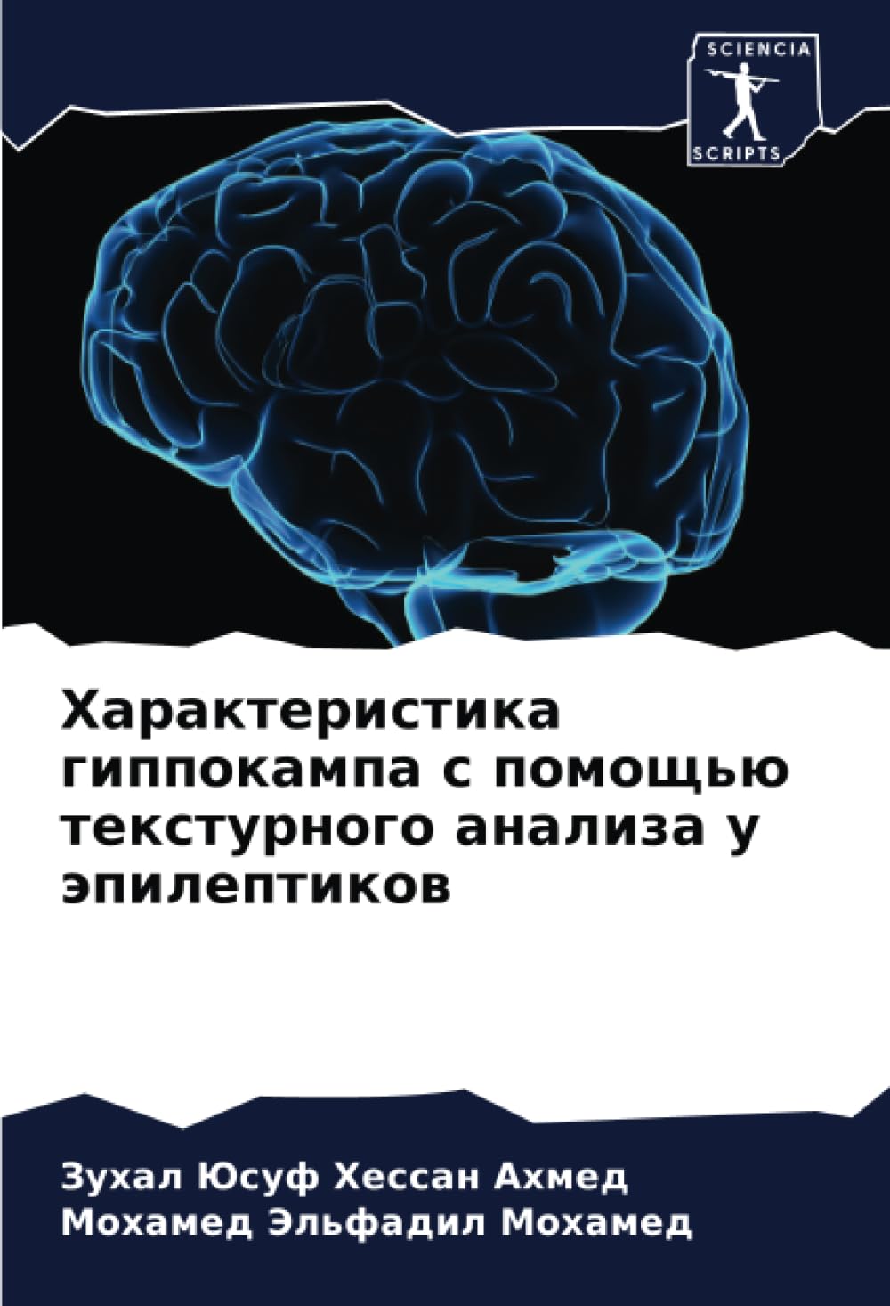 Harakteristika gippokampa s pomosch'ü texturnogo analiza u äpileptikow Medicine