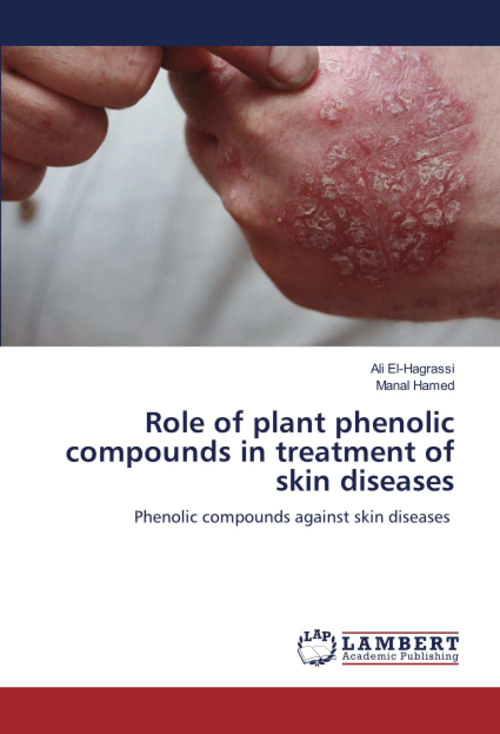 Role of plant phenolic compounds in treatment of skin diseases Medicine