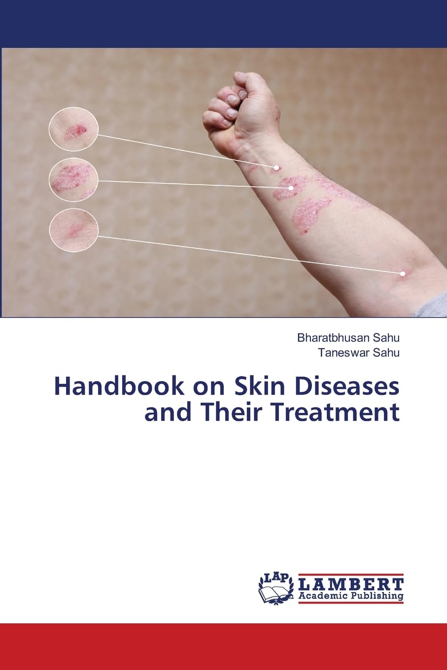 Handbook on Skin Diseases and Their Treatment Medicine