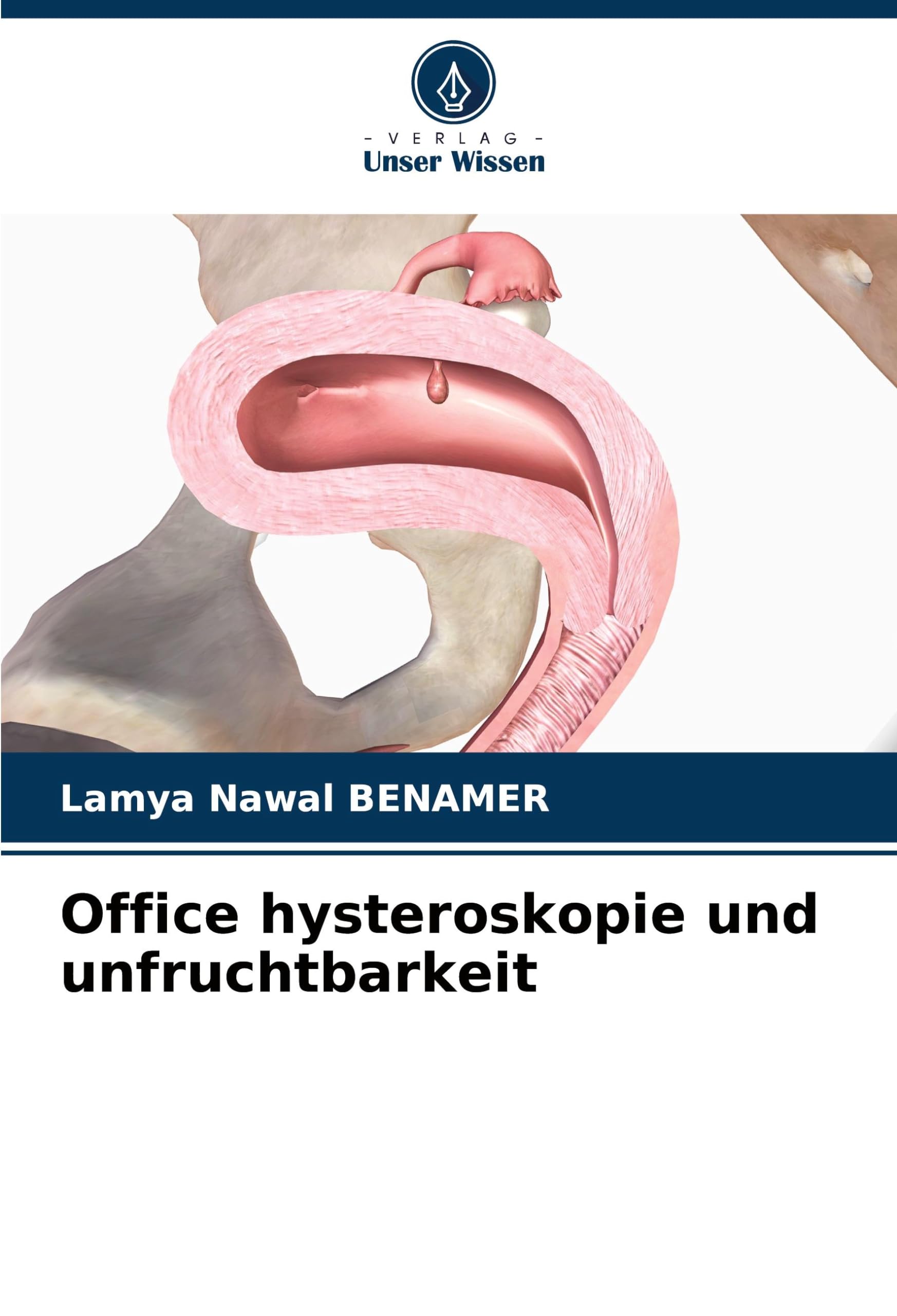 Office hysteroskopie und unfruchtbarkeit: DE Medicine