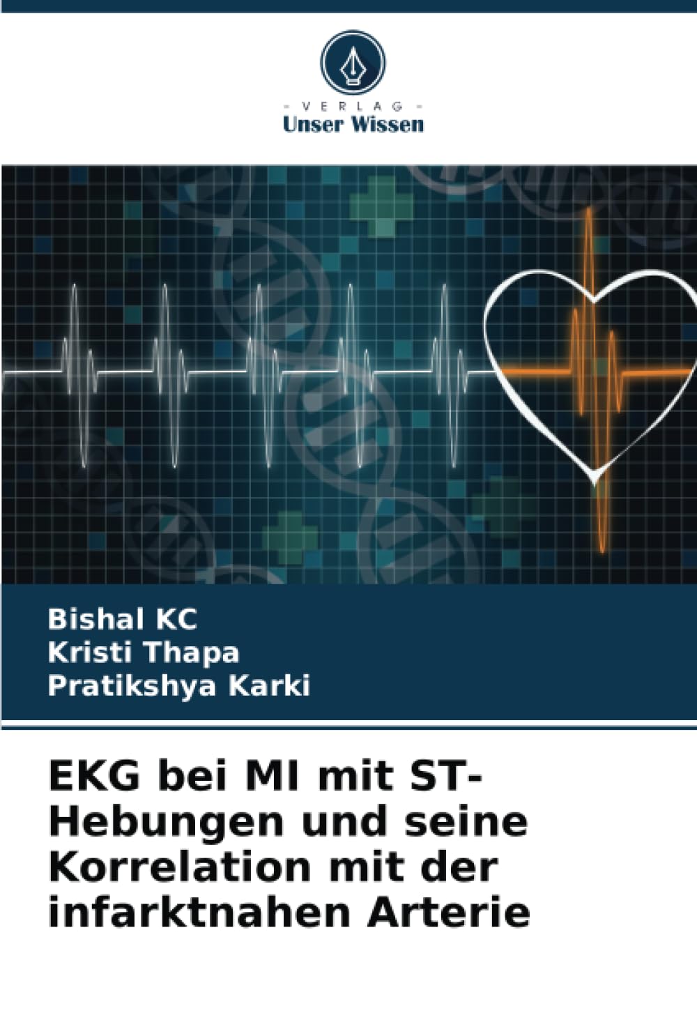 EKG bei MI mit ST-Hebungen und seine Korrelation mit der infarktnahen Arterie Medicine