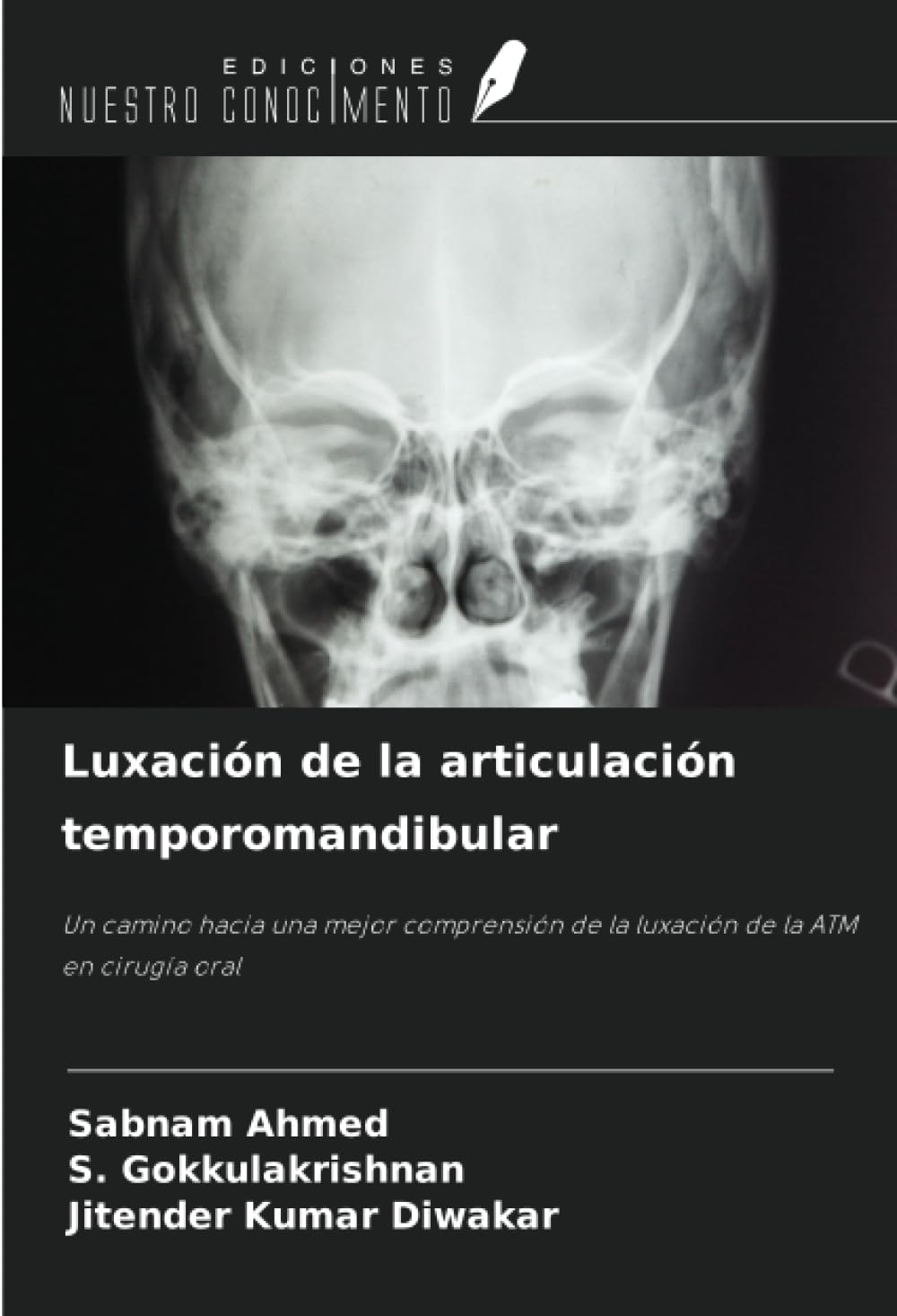 Luxación de la articulación temporomandibular: Un camino hacia una mejor comprensión de la luxación de la ATM en cirugía oral Business, Finance & Career