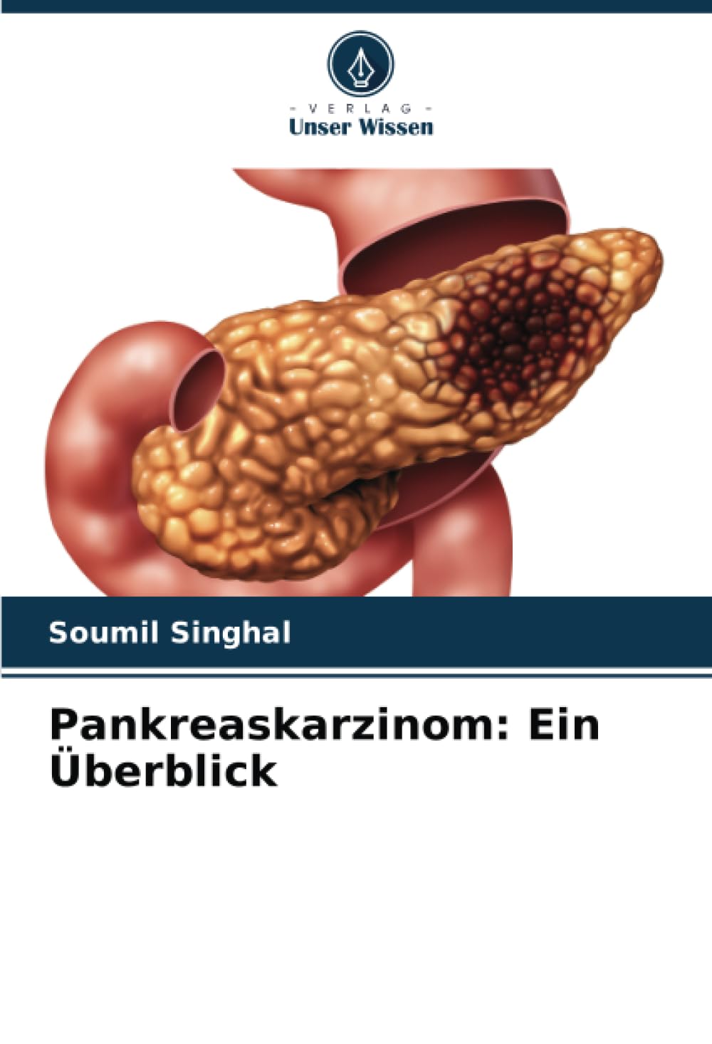 Product Image: Pankreaskarzinom: Ein Überblick: DE