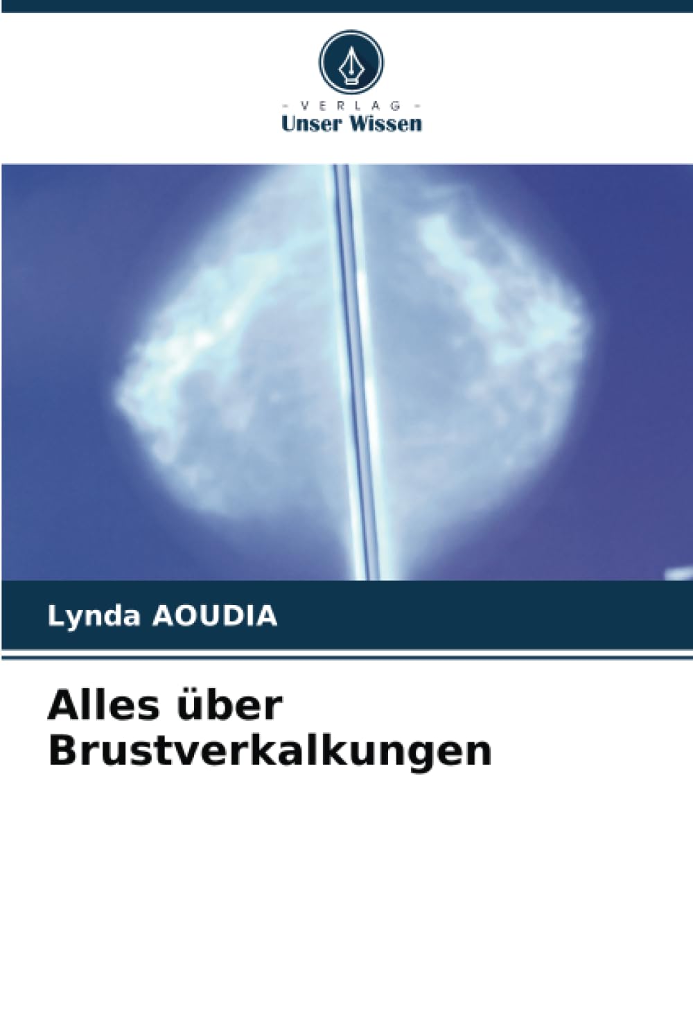 Alles über Brustverkalkungen: DE Medicine