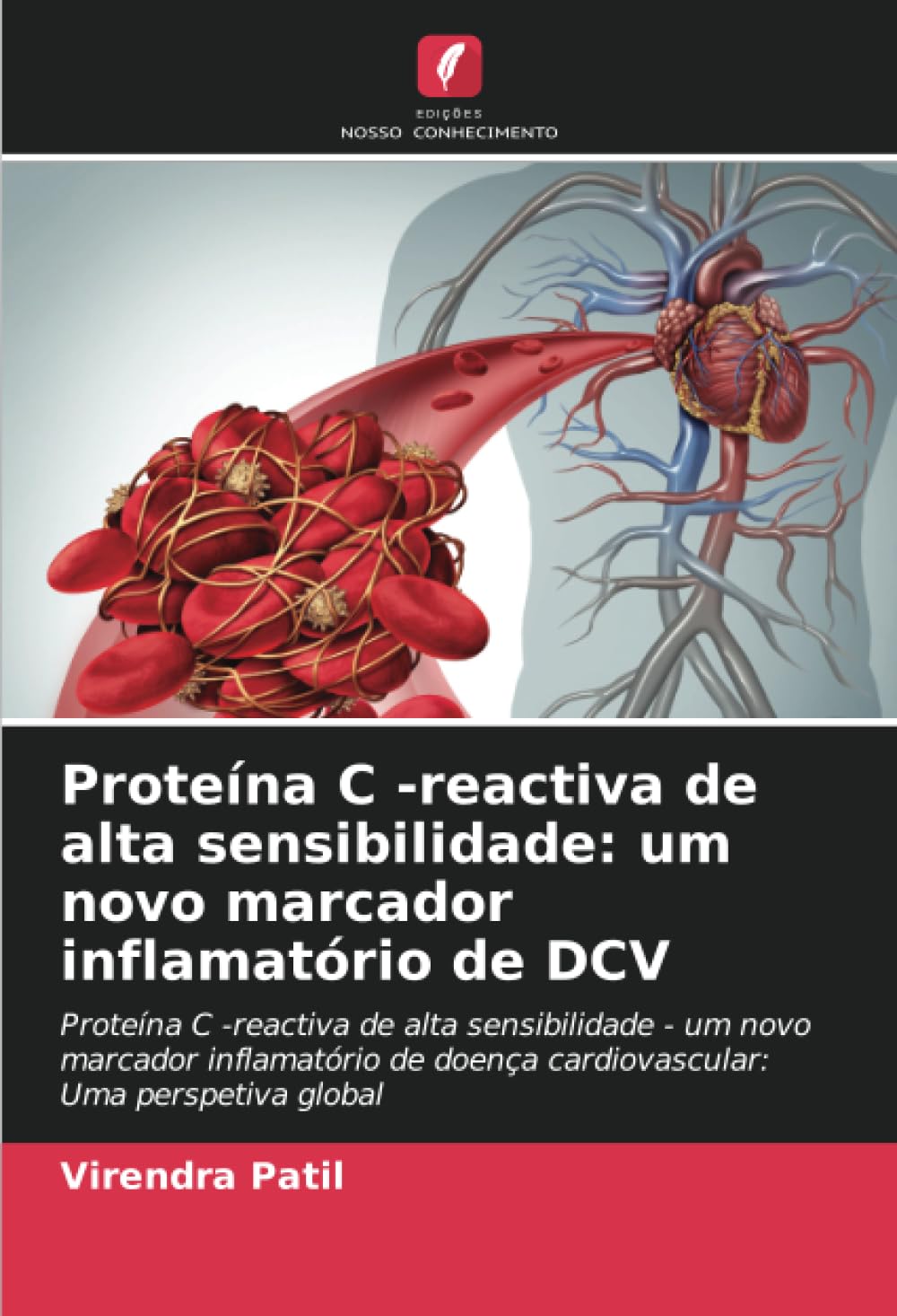Proteína C -reactiva de alta sensibilidade: um novo marcador inflamatório de DCV Medicine