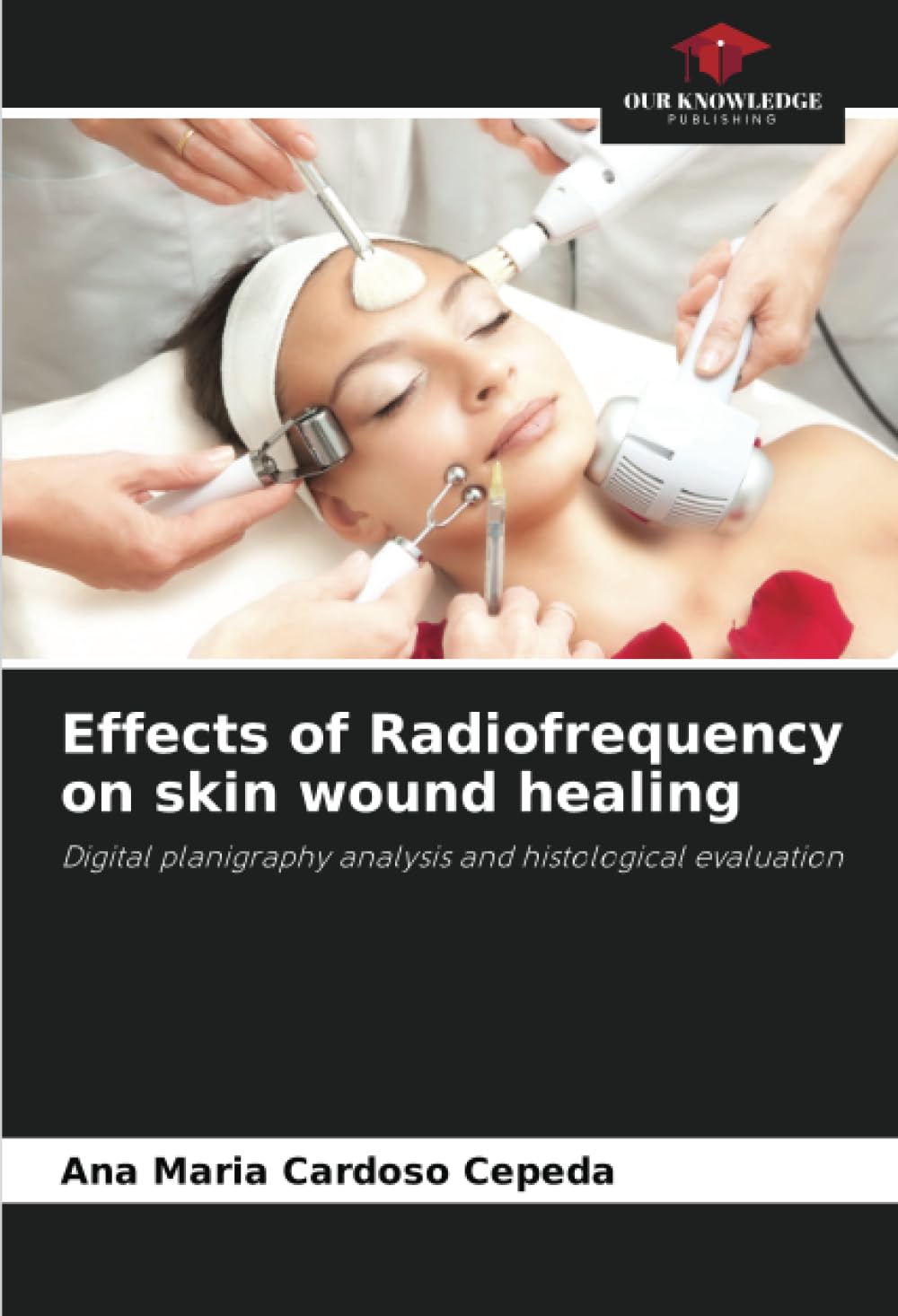 Effects of Radiofrequency on skin wound healing Medicine