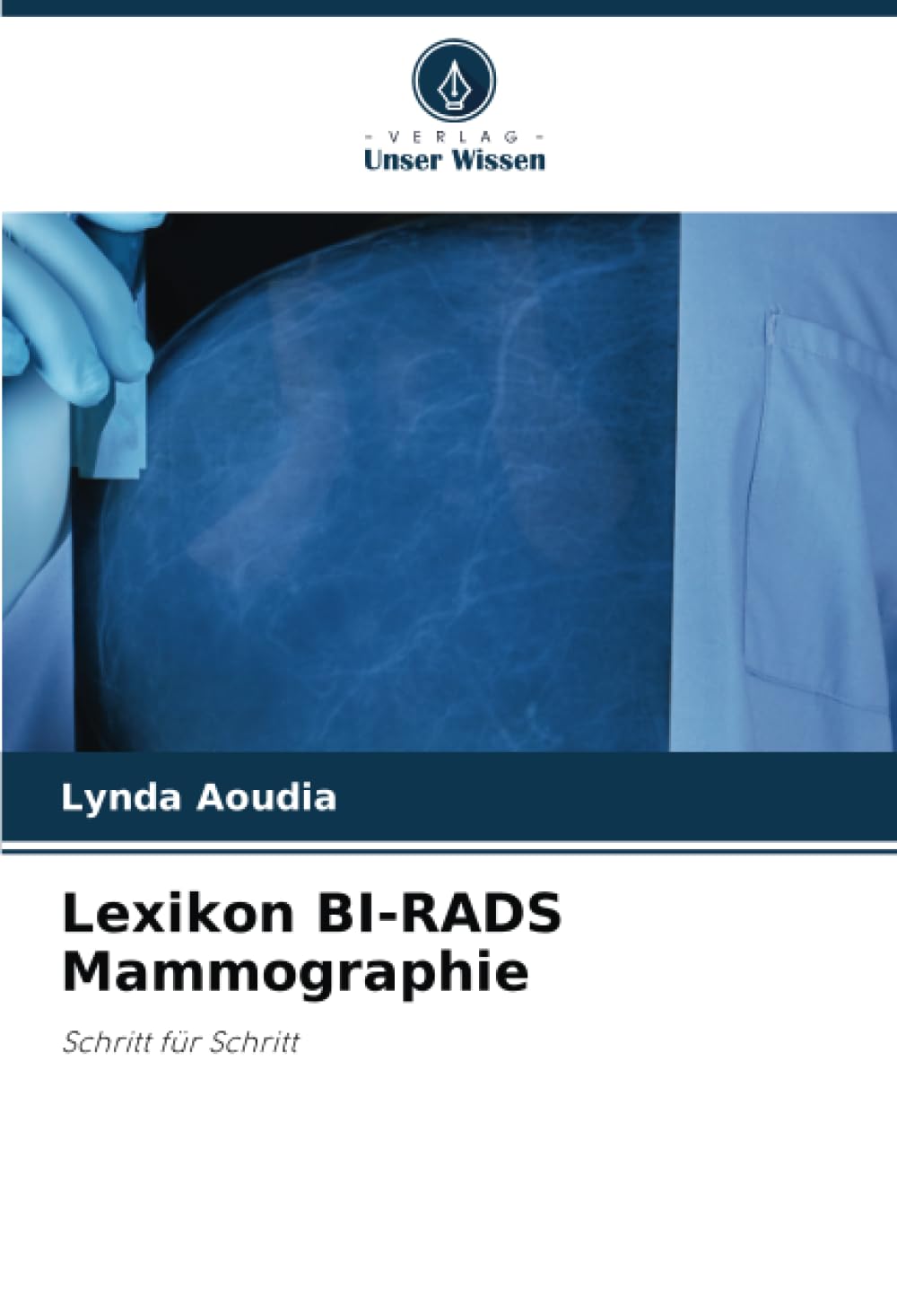 Lexikon BI-RADS Mammographie: Schritt für Schritt Medicine