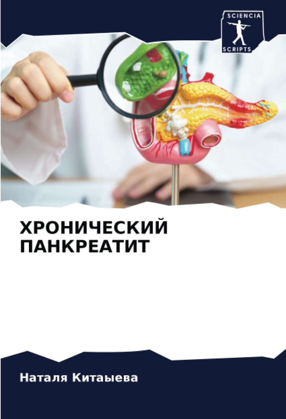 HRONIChESKIJ PANKREATIT Law