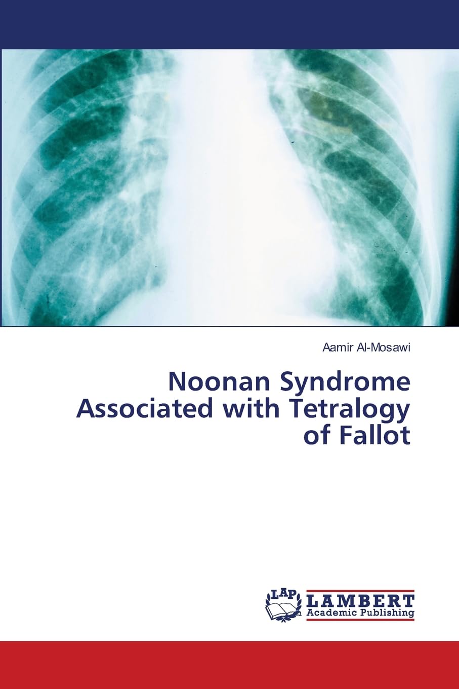 Noonan Syndrome Associated with Tetralogy of Fallot Medicine