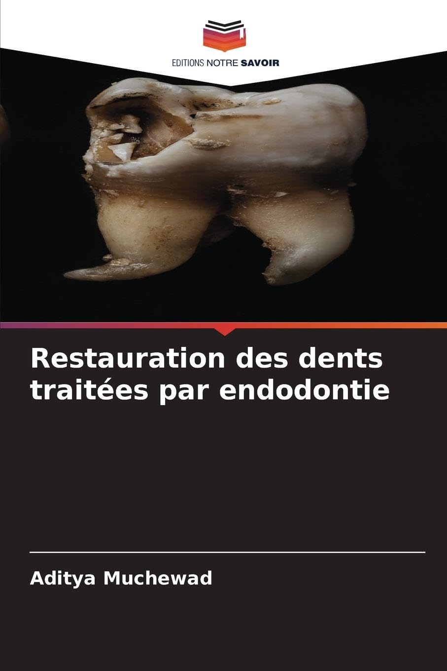 Restauration des dents traitées par endodontie Medicine