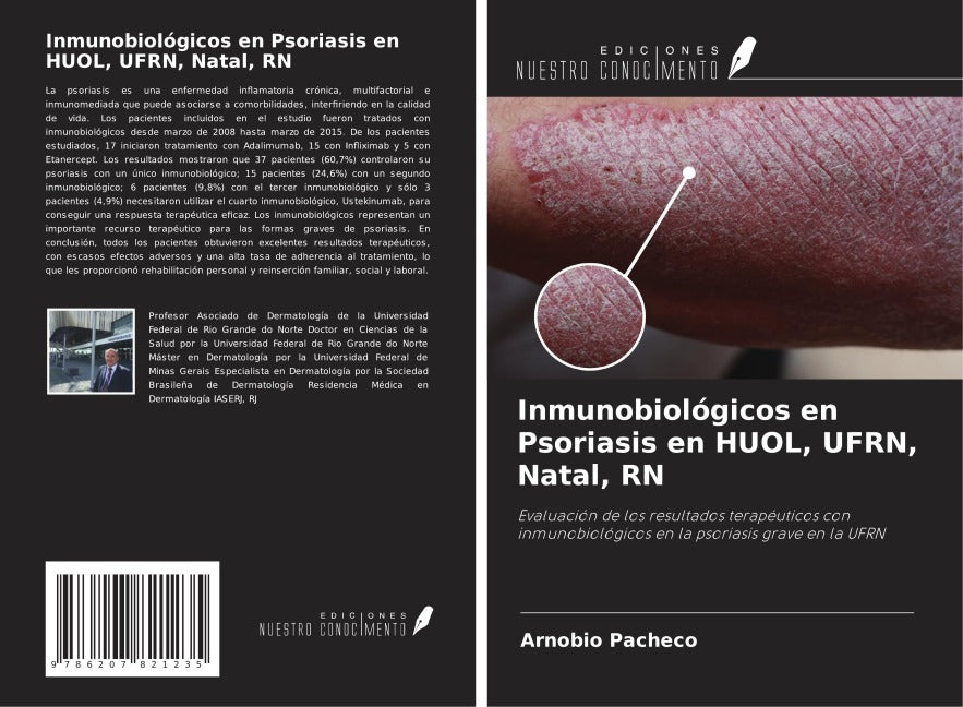 Inmunobiológicos en Psoriasis en HUOL, UFRN, Natal, RN Medicine