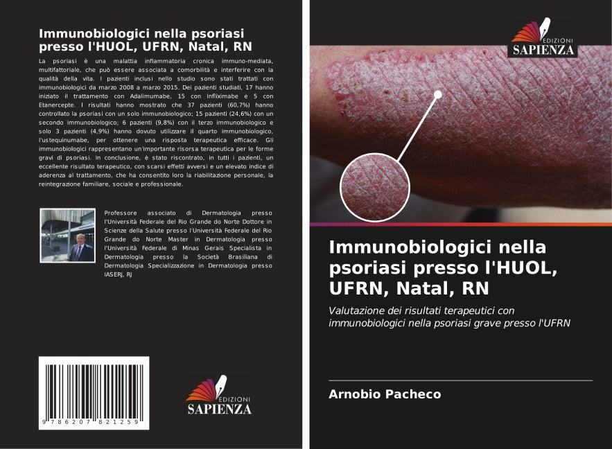 Immunobiologici nella psoriasi presso l'HUOL, UFRN, Natal, RN Medicine