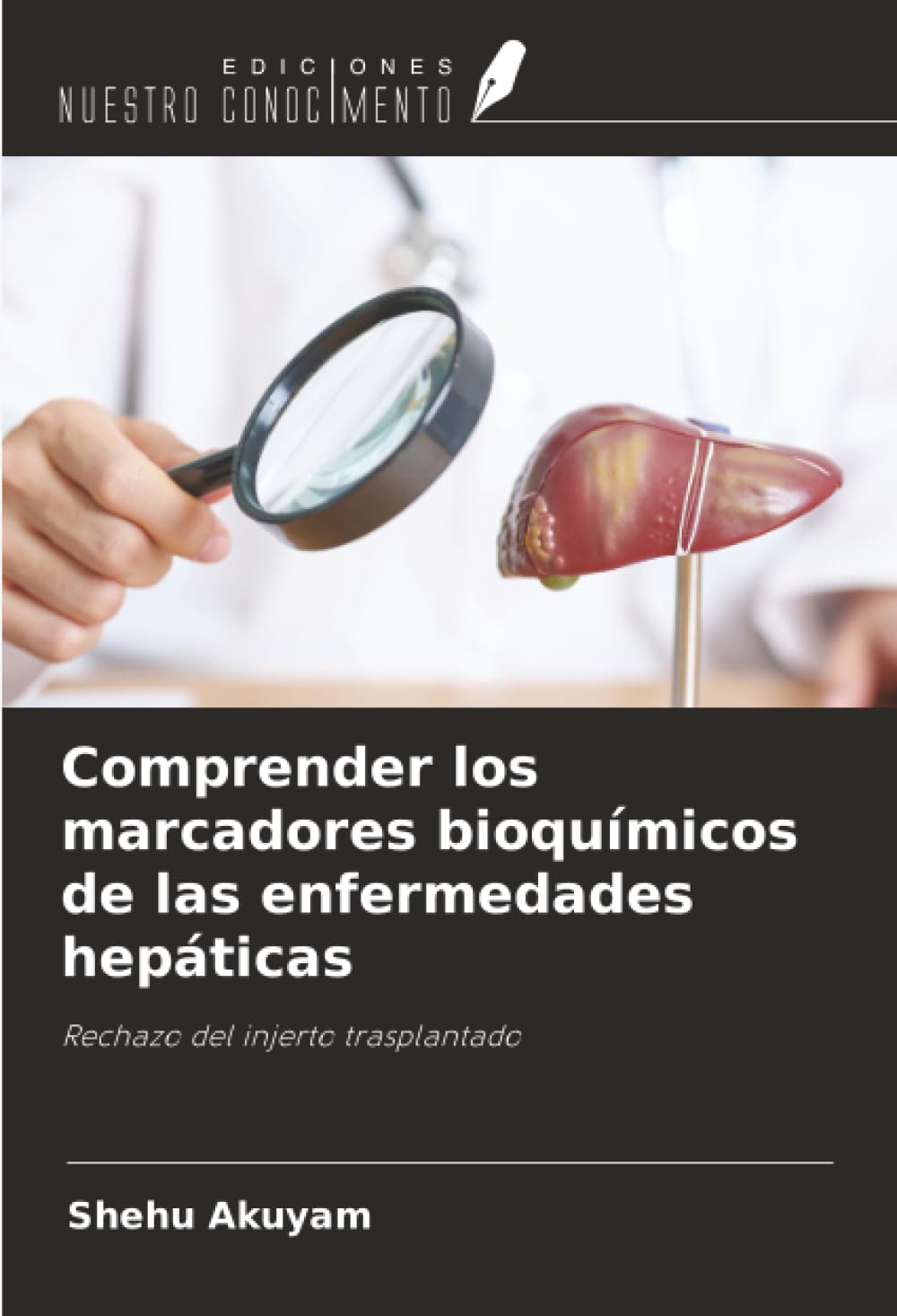 Comprender los marcadores bioquímicos de las enfermedades hepáticas Medicine