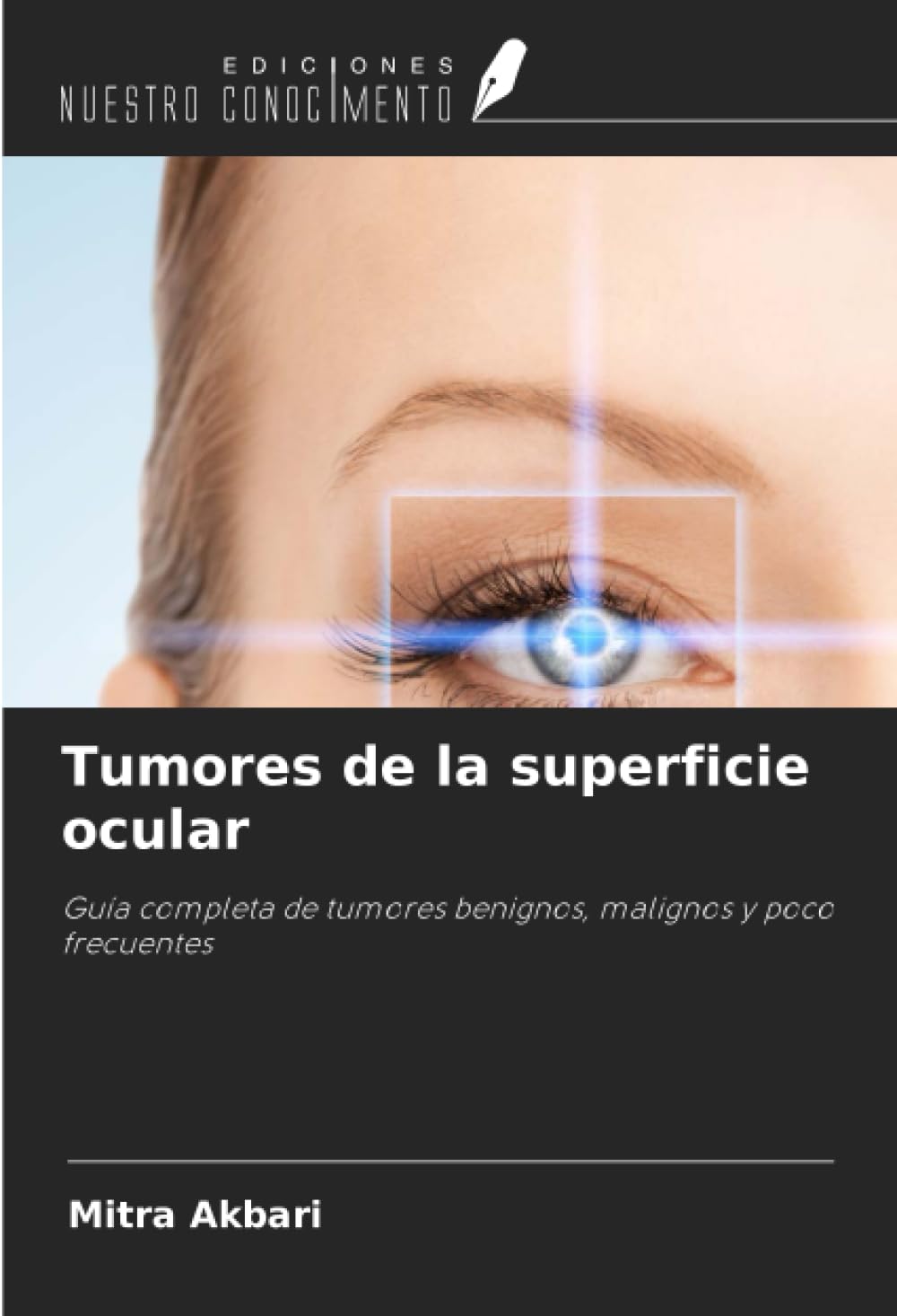 Tumores de la superficie ocular: Guía completa de tumores benignos, malignos y poco frecuentes Medicine
