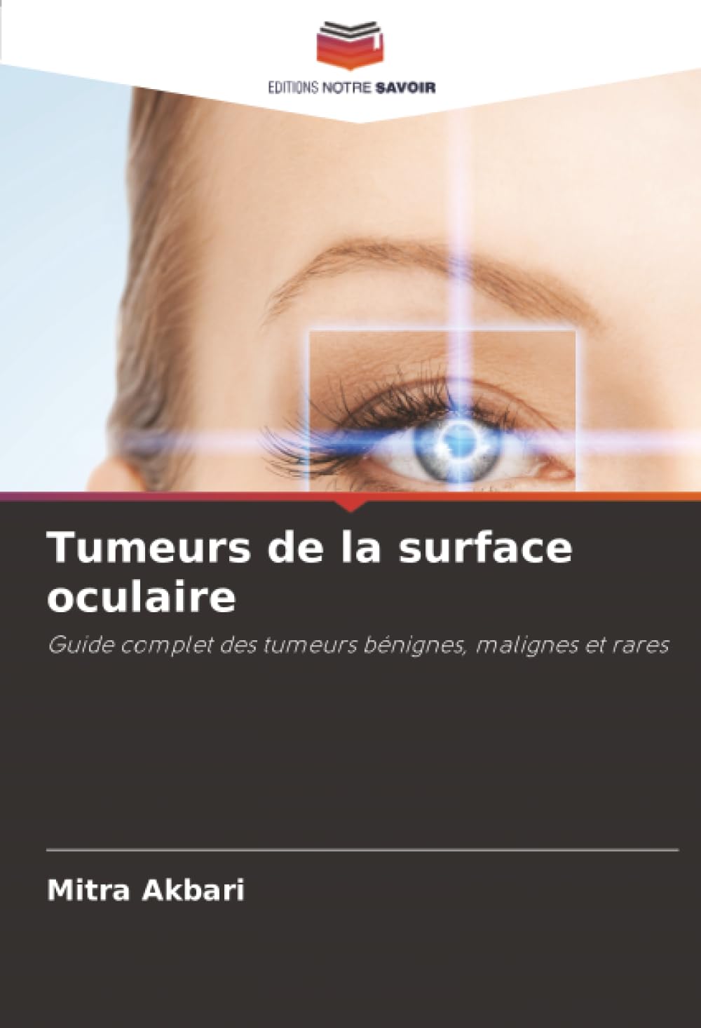 Tumeurs de la surface oculaire: Guide complet des tumeurs bénignes, malignes et rares Medicine