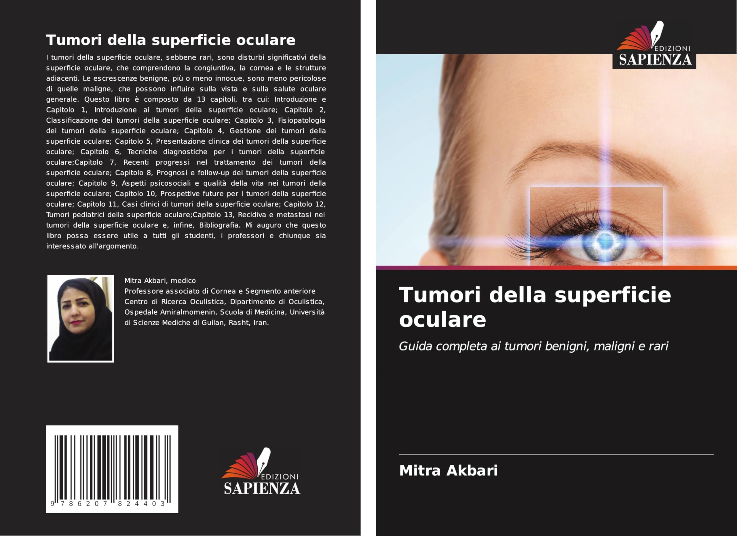 Tumori della superficie oculare Medicine