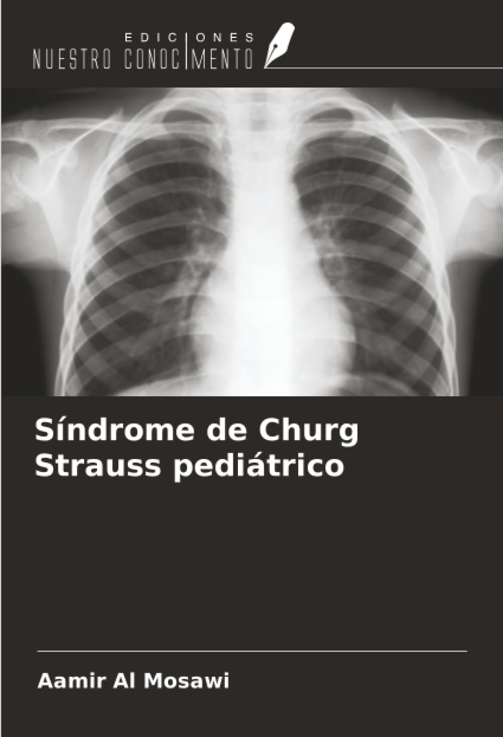Síndrome de Churg Strauss pediátrico Medicine