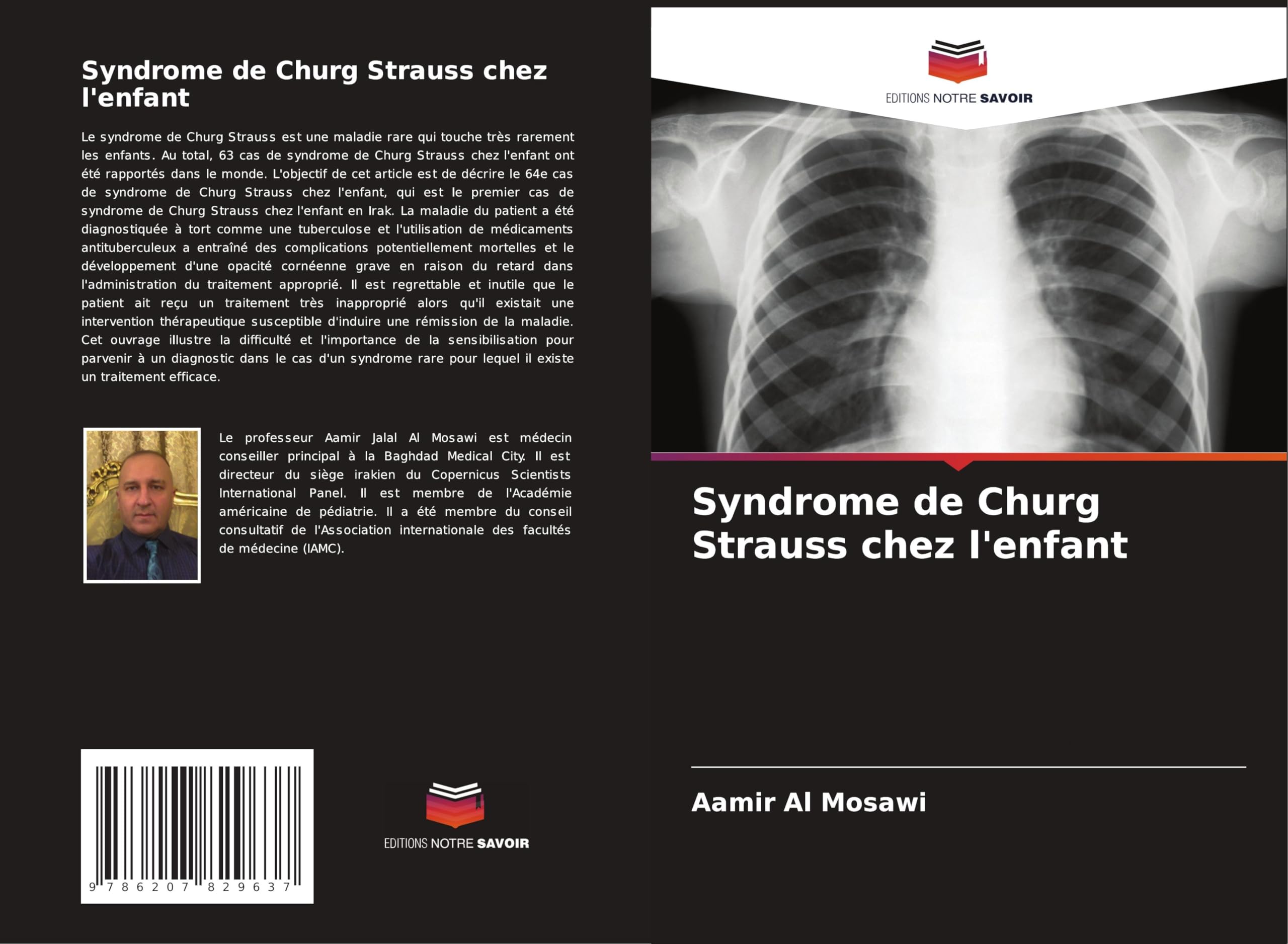 Syndrome de Churg Strauss chez l'enfant Medicine