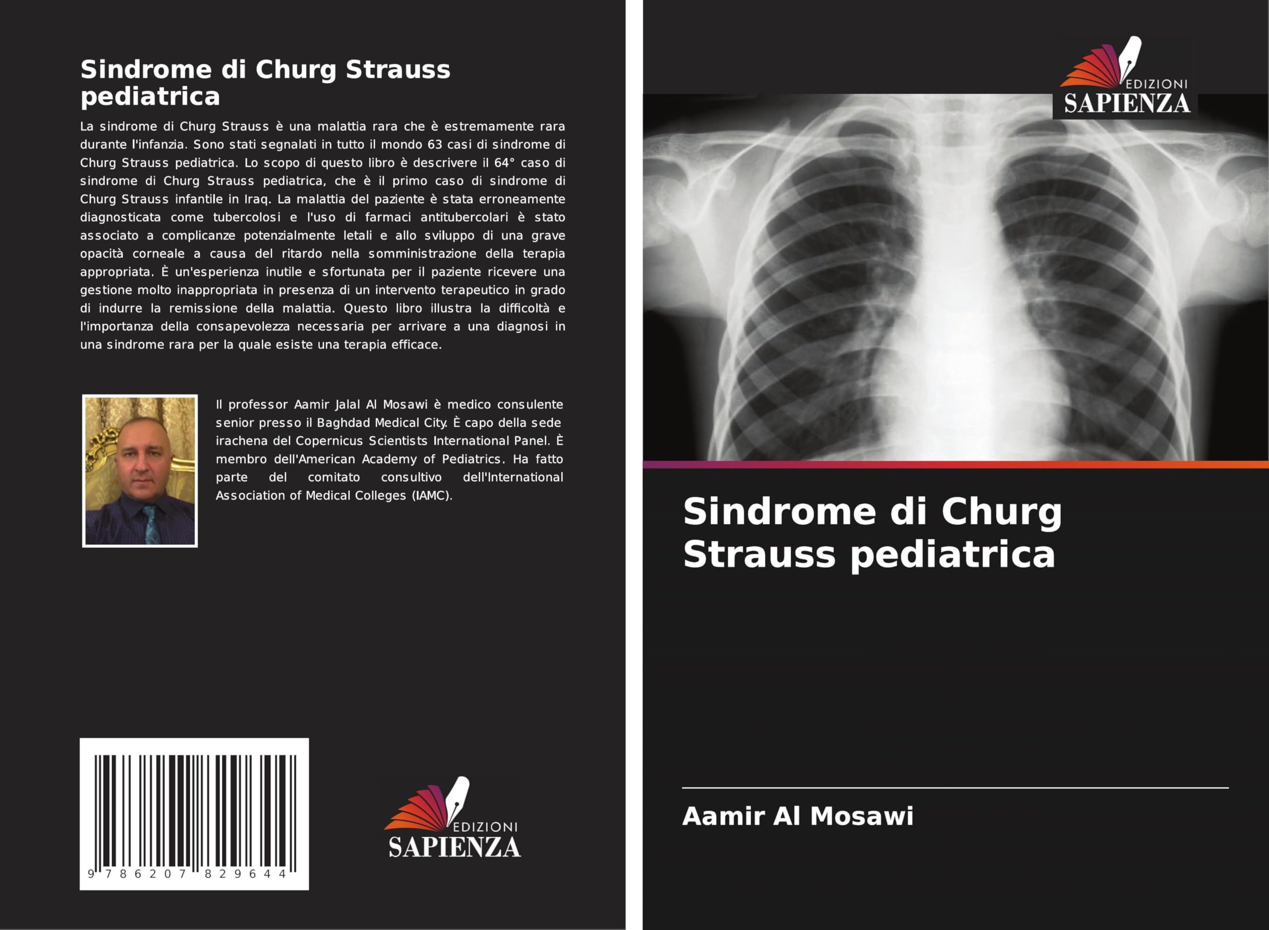 Sindrome di Churg Strauss pediatrica Medicine