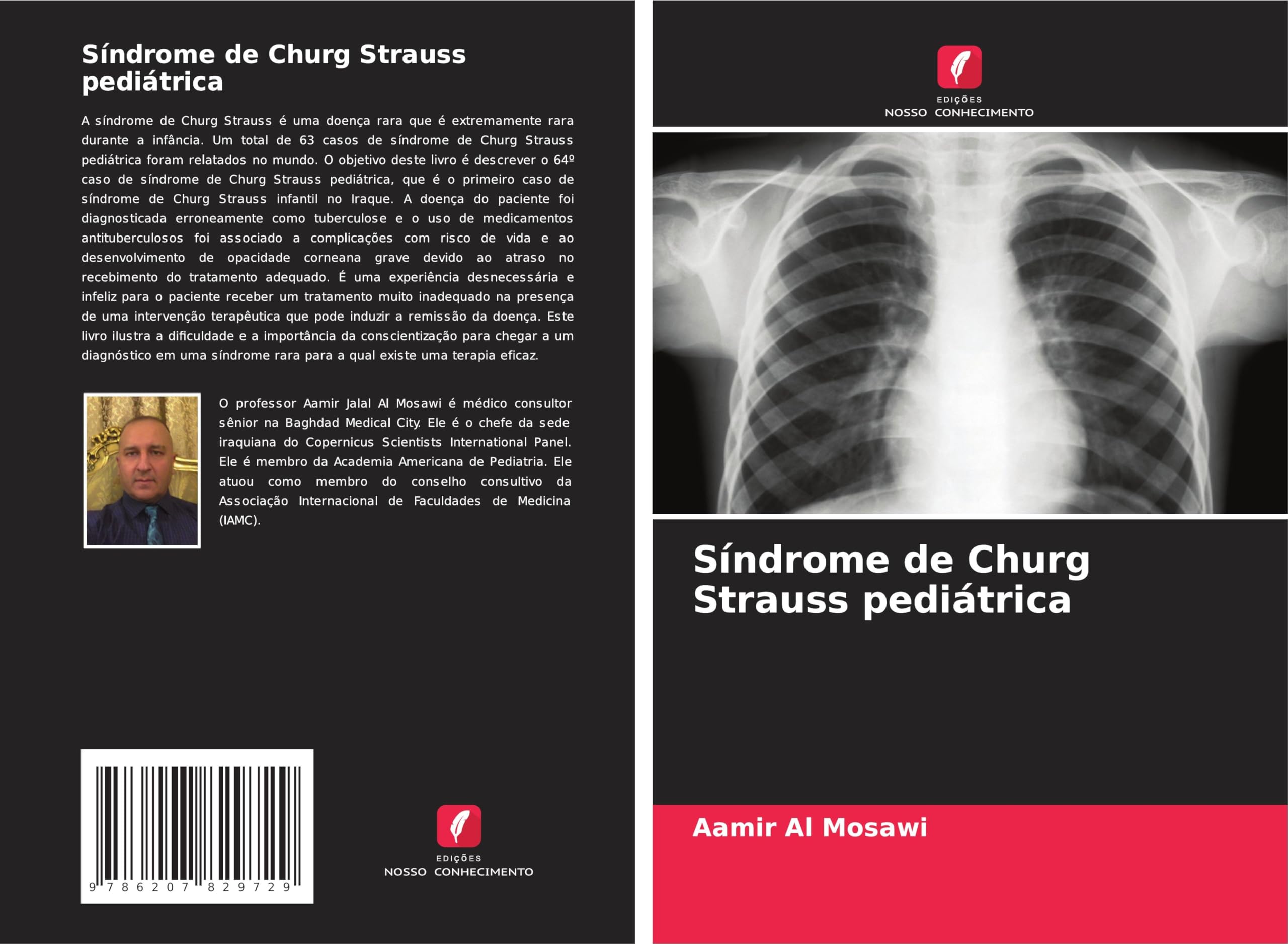 Síndrome de Churg Strauss pediátrica Medicine