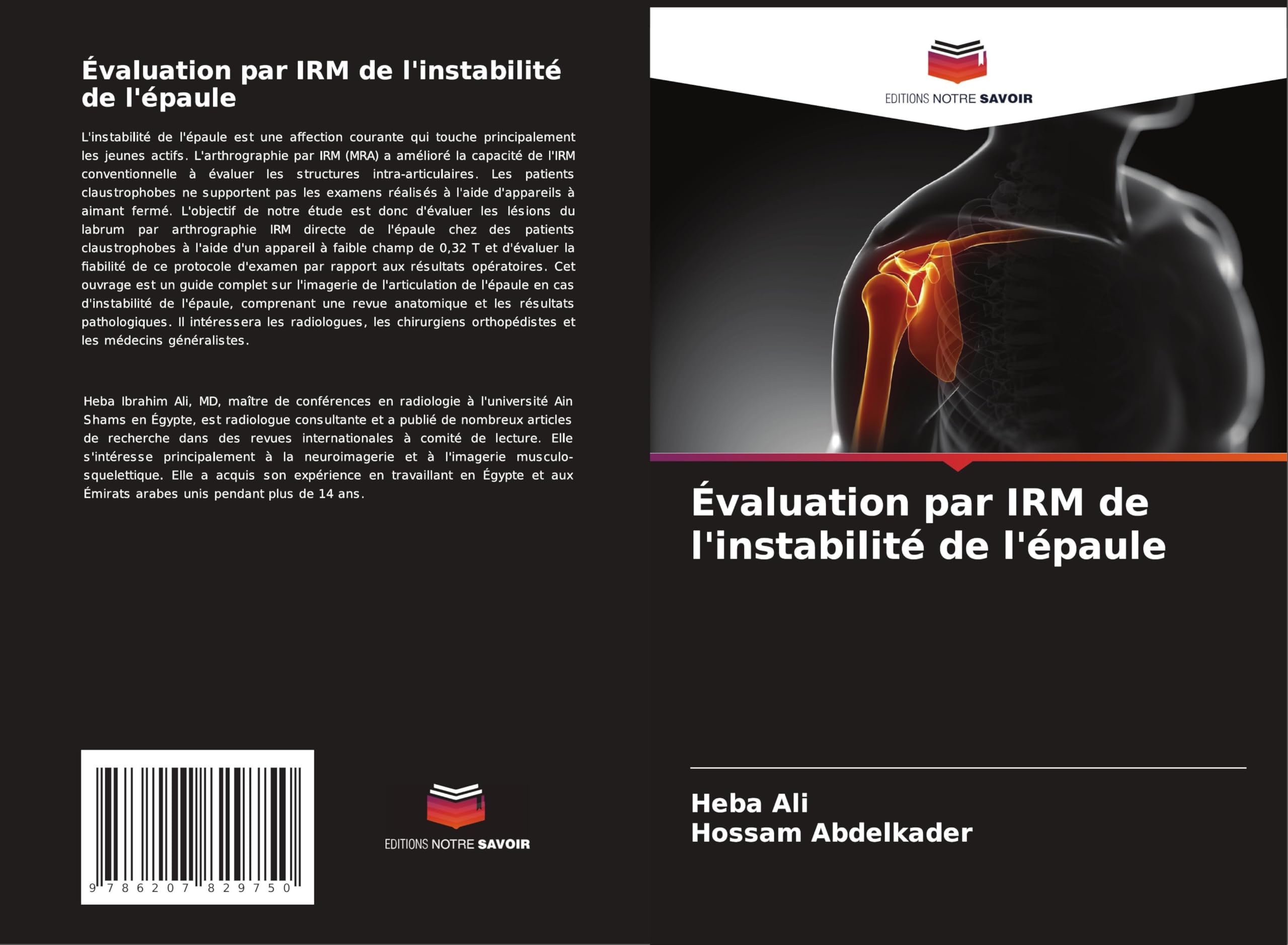 Évaluation par IRM de l'instabilité de l'épaule Medicine