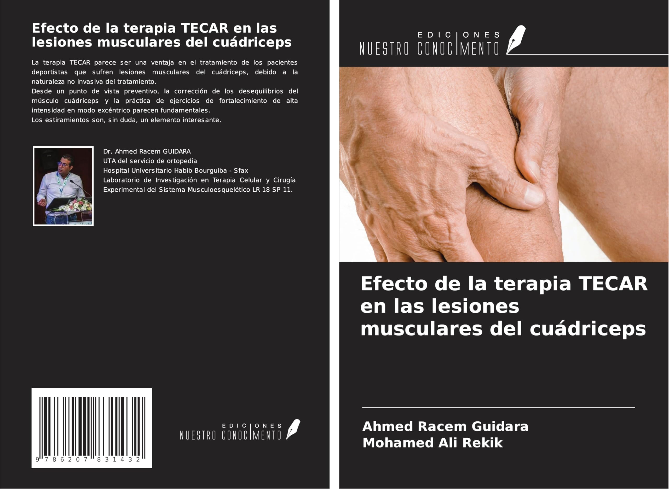 Efecto de la terapia TECAR en las lesiones musculares del cuádriceps Arts & Music