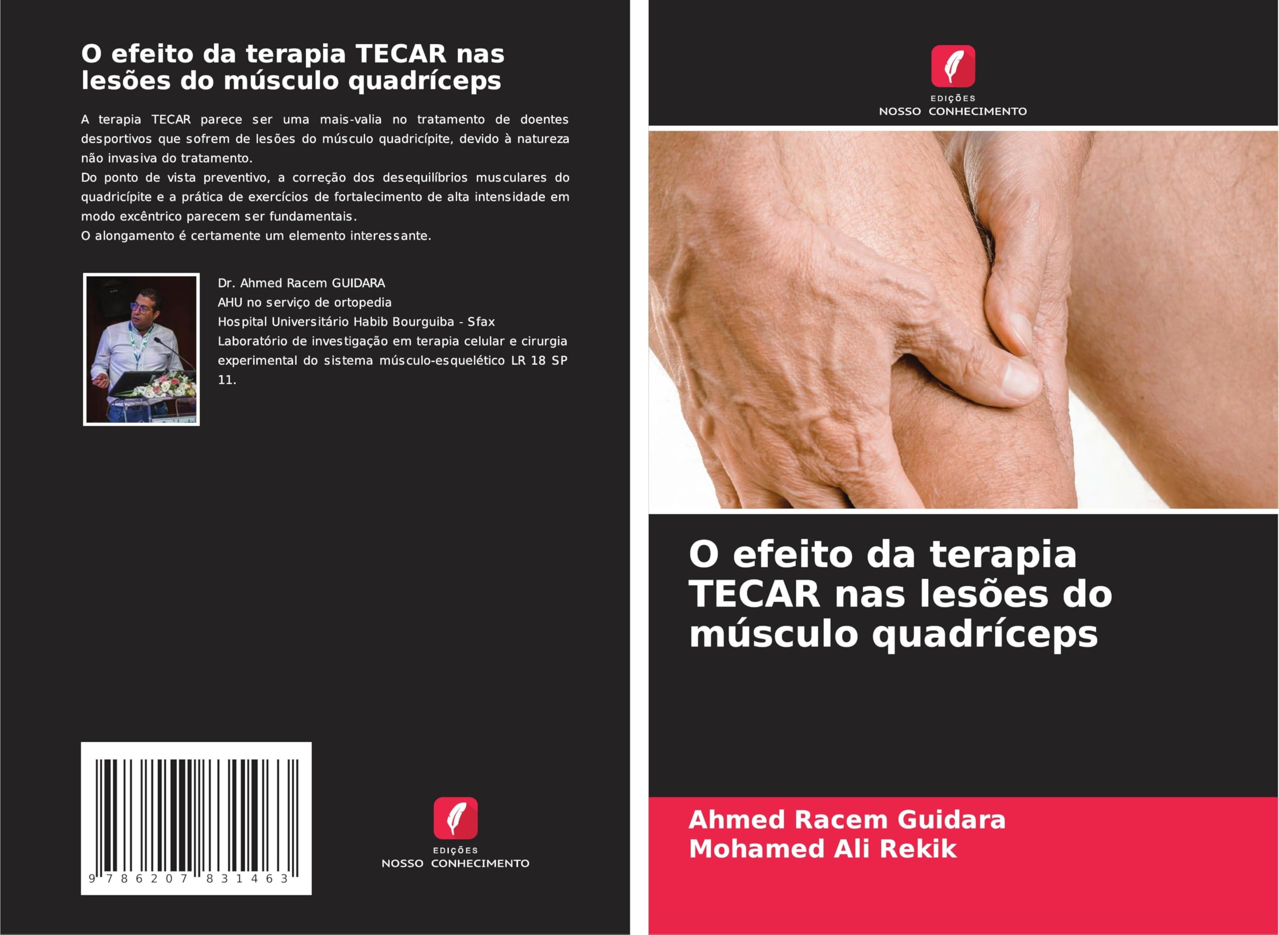 O efeito da terapia TECAR nas lesões do músculo quadríceps Arts & Music