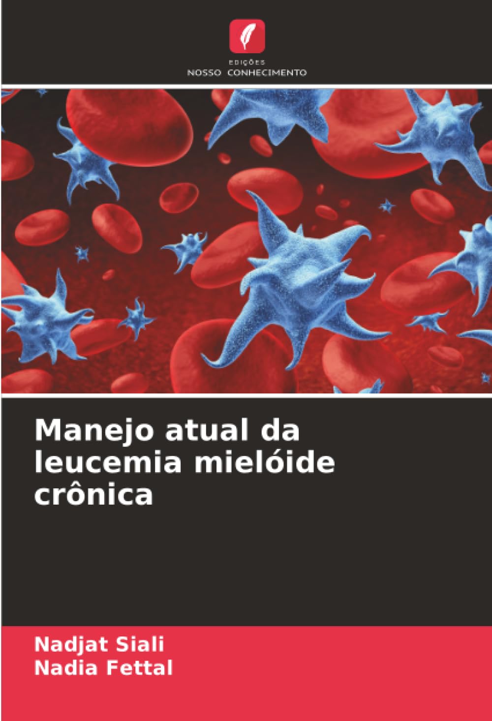 Manejo atual da leucemia mielóide crônica Medicine