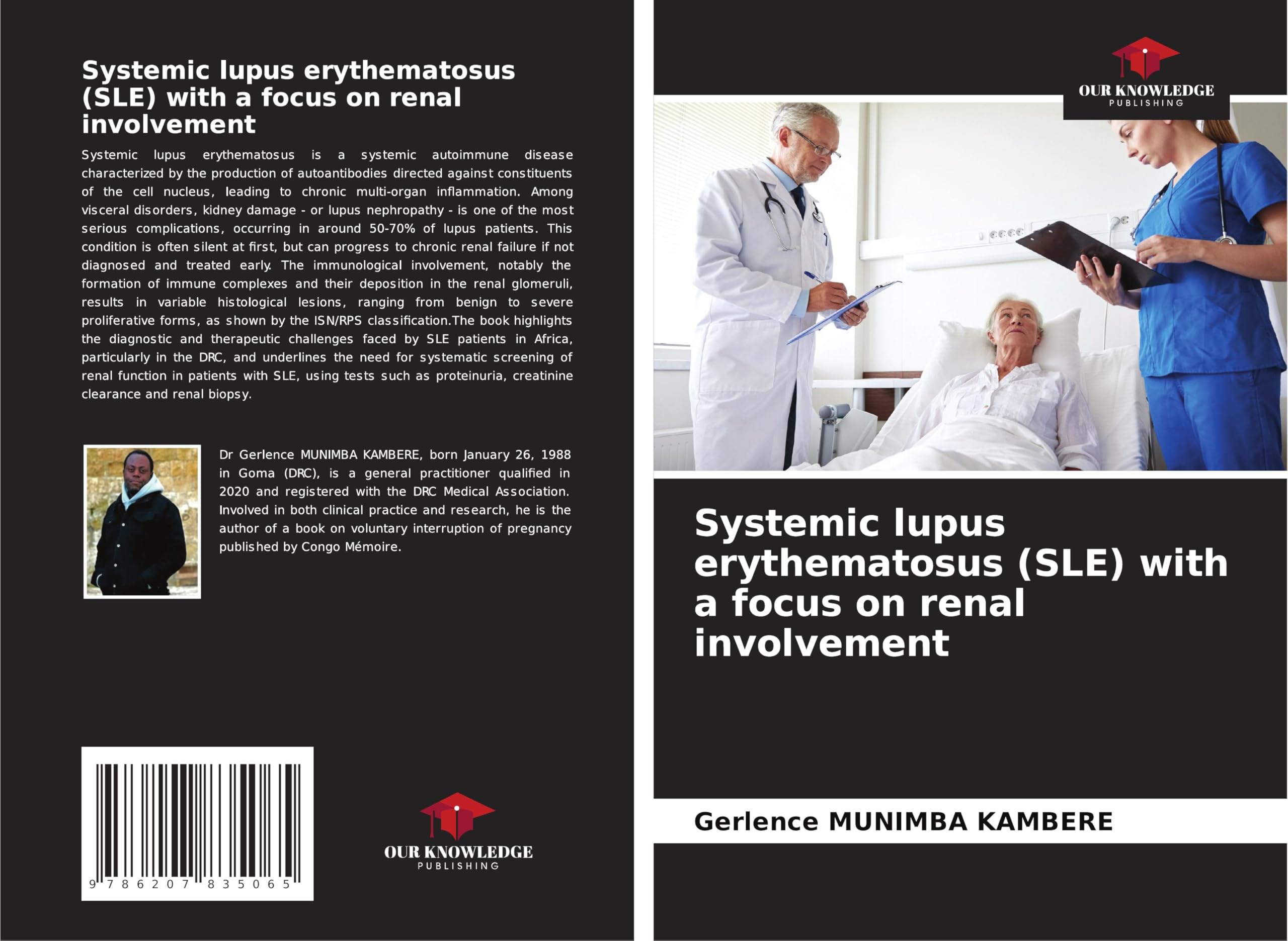 Systemic lupus erythematosus (SLE) with a focus on renal involvement Medicine