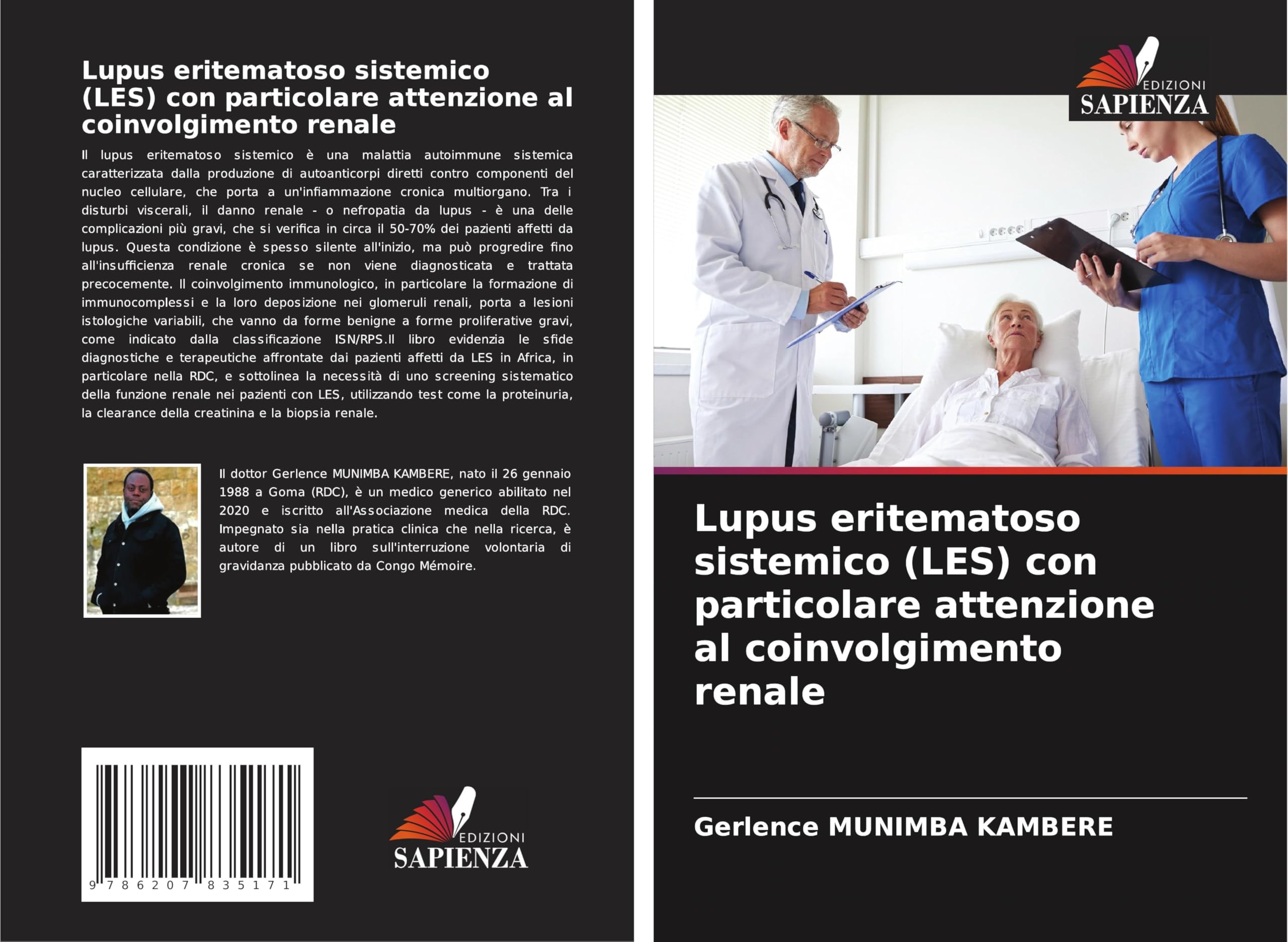 Lupus eritematoso sistemico (LES) con particolare attenzione al coinvolgimento renale Medicine