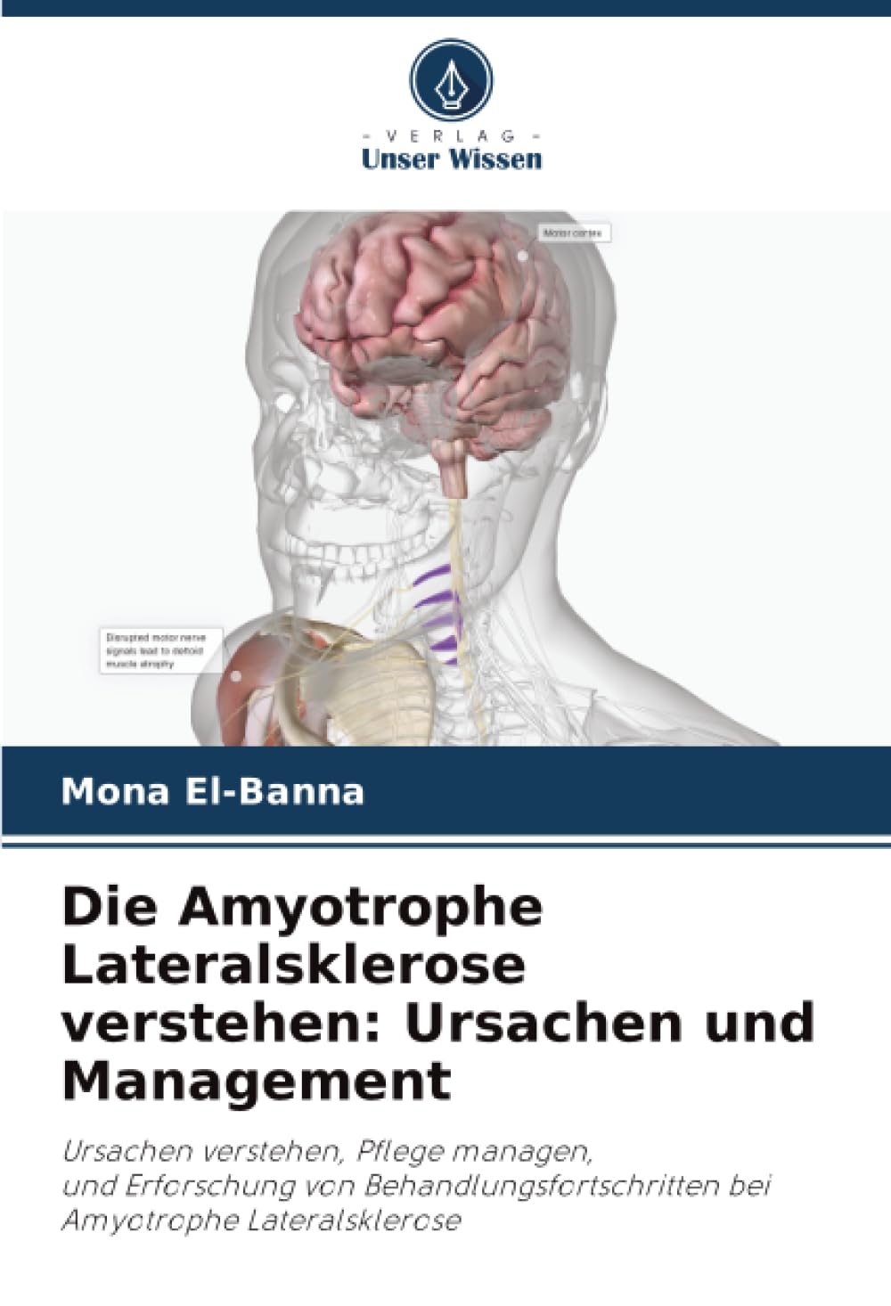 Die Amyotrophe Lateralsklerose verstehen: Ursachen und Management Natural Sciences