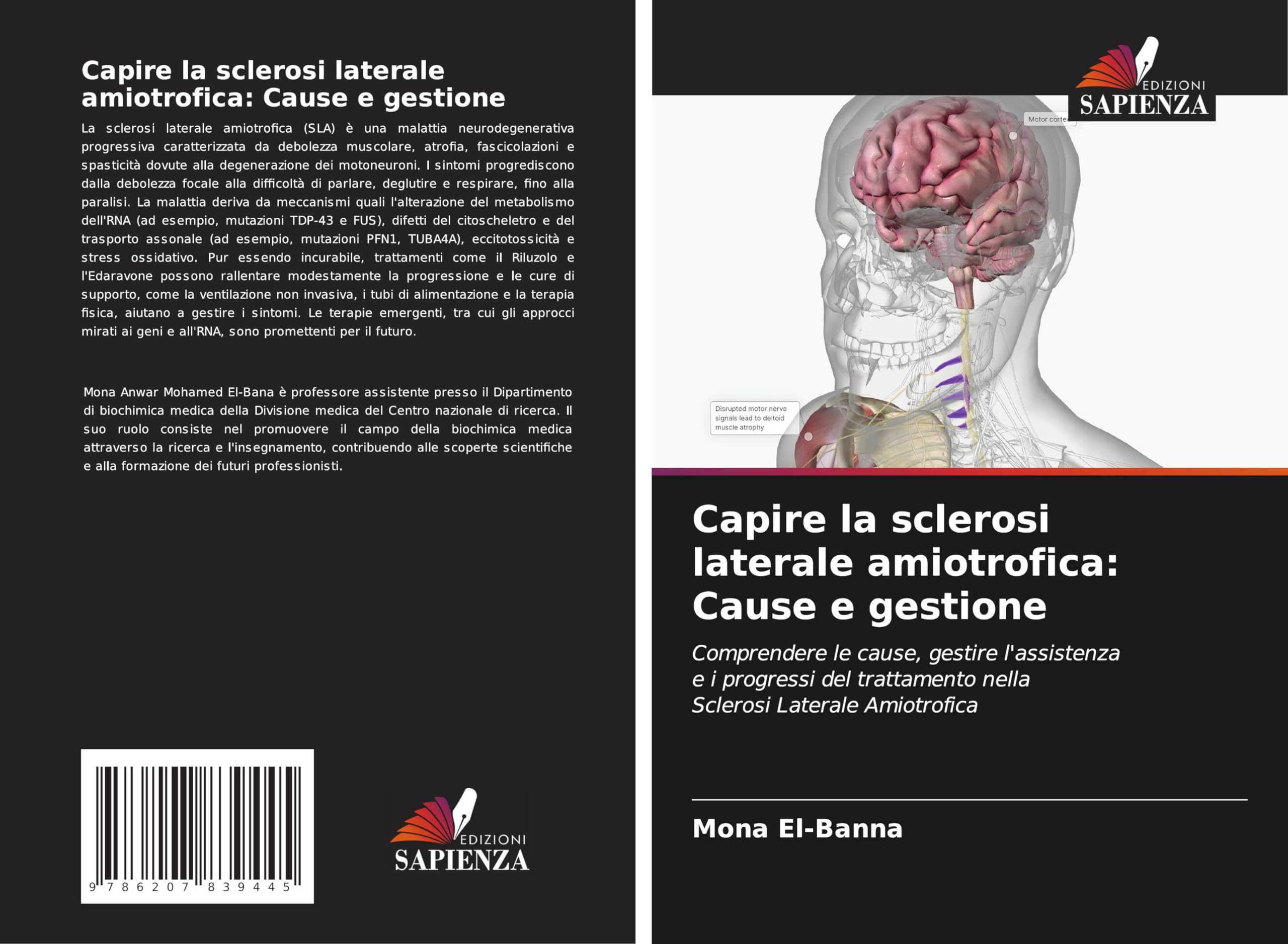 Capire la sclerosi laterale amiotrofica: Cause e gestione Natural Sciences