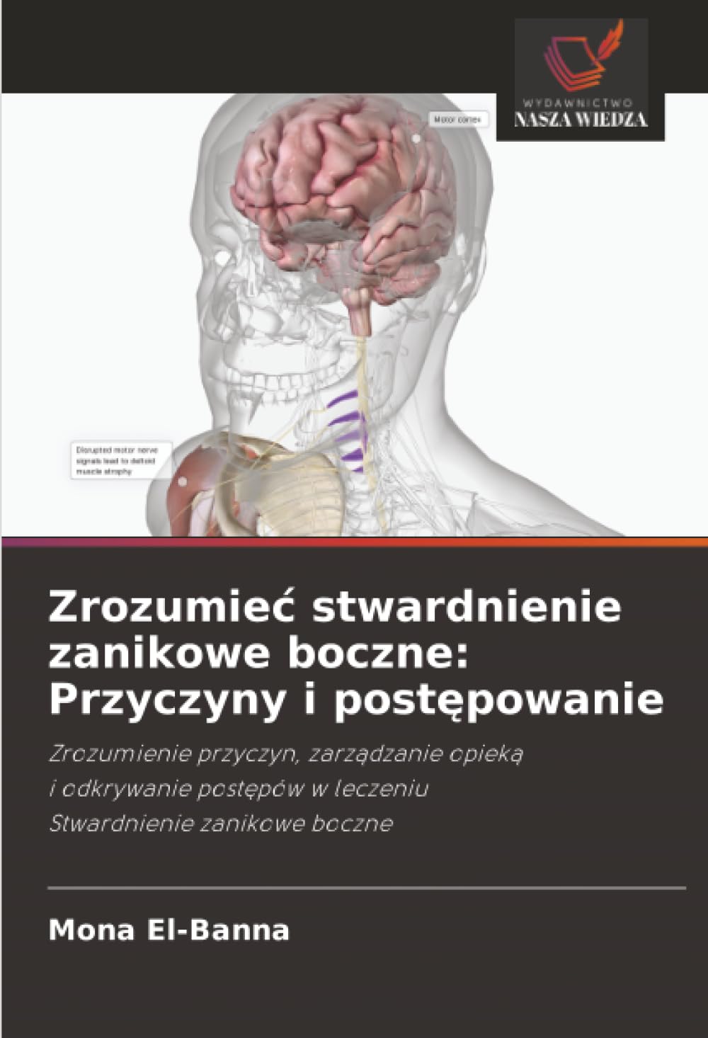 Zrozumie¿ stwardnienie zanikowe boczne: Przyczyny i post¿powanie Natural Sciences