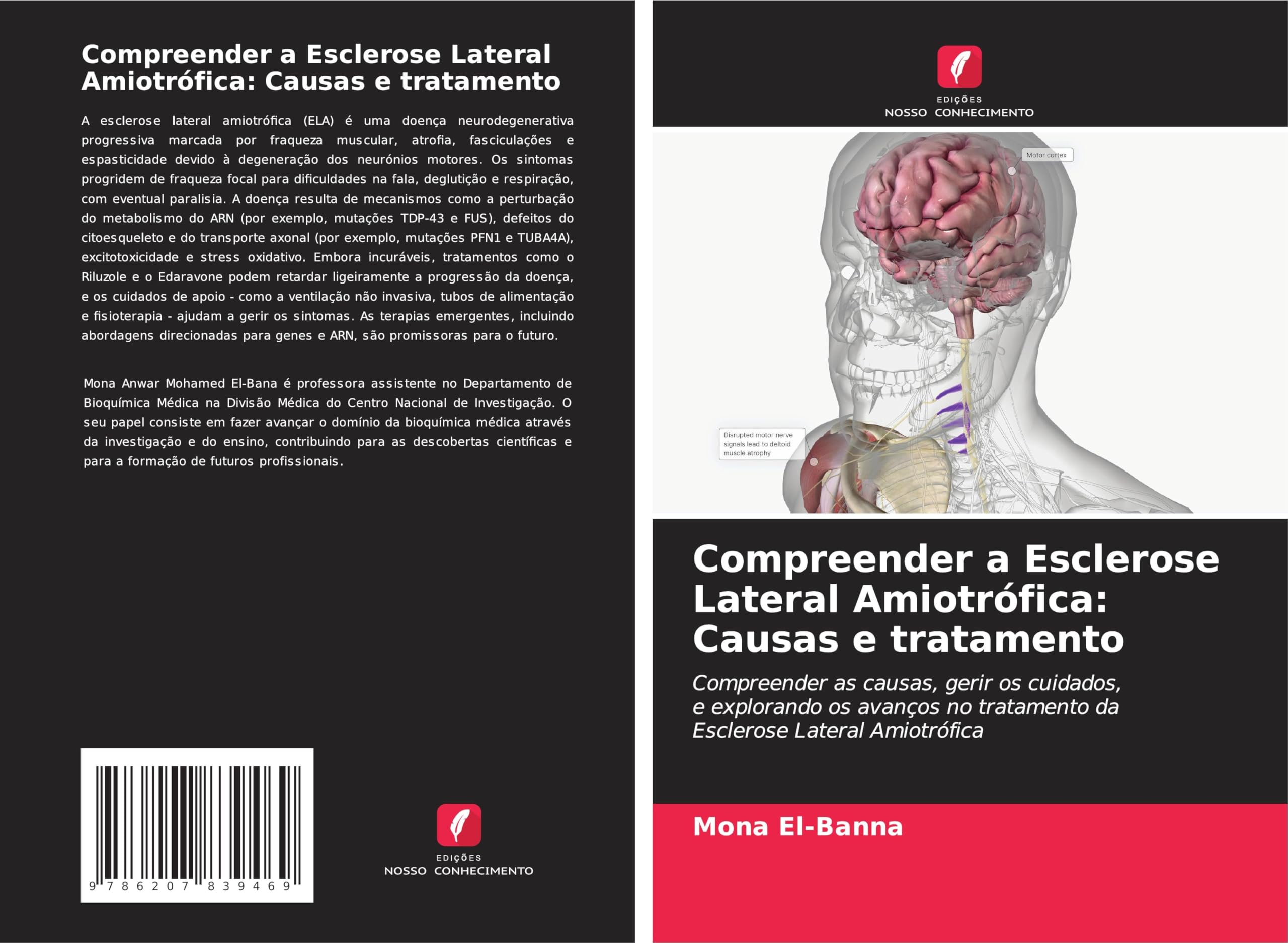 Compreender a Esclerose Lateral Amiotrófica: Causas e tratamento Natural Sciences