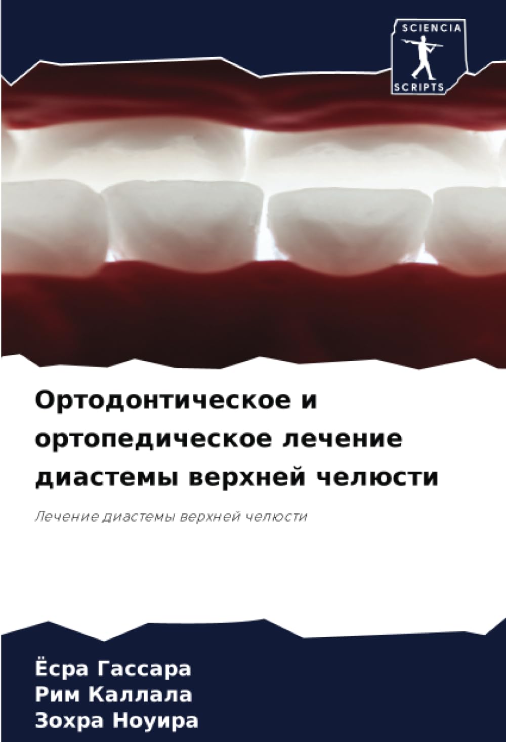Ортодонтическое и ортопедическое лечение диастемы верхней челюсти: Лечение диастемы верхней челюсти: Lechenie diastemy werhnej chelüsti Medicine