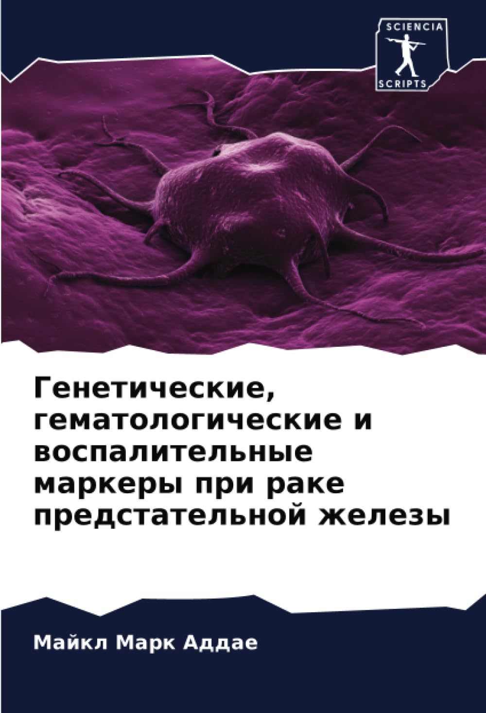 Geneticheskie, gematologicheskie i wospalitel'nye markery pri rake predstatel'noj zhelezy Medicine