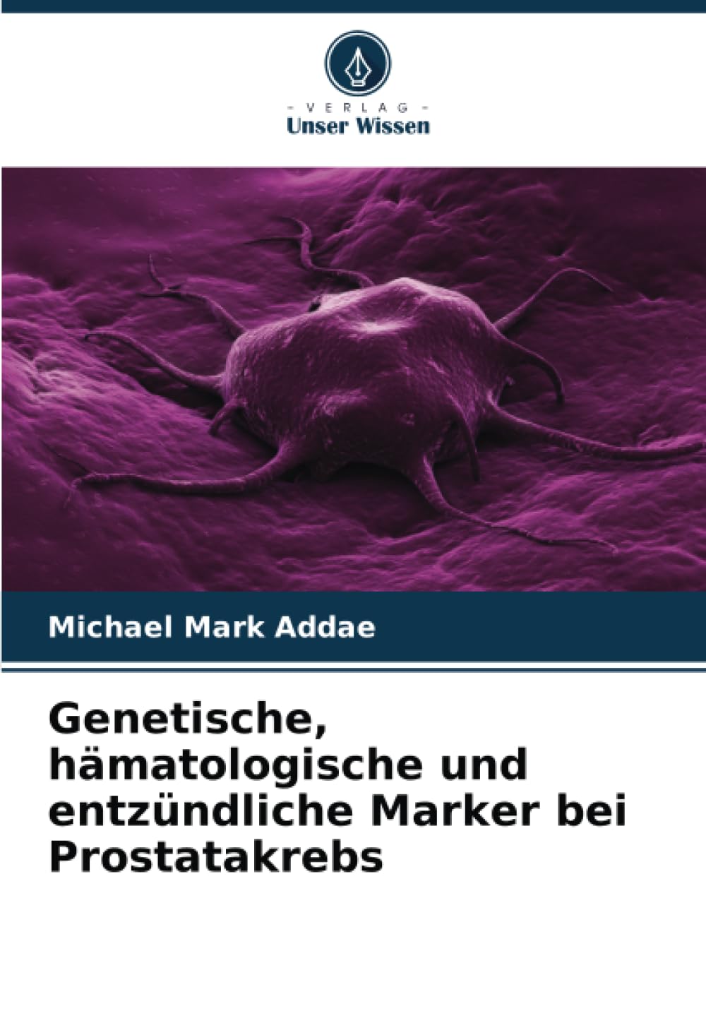 Genetische, hämatologische und entzündliche Marker bei Prostatakrebs Medicine