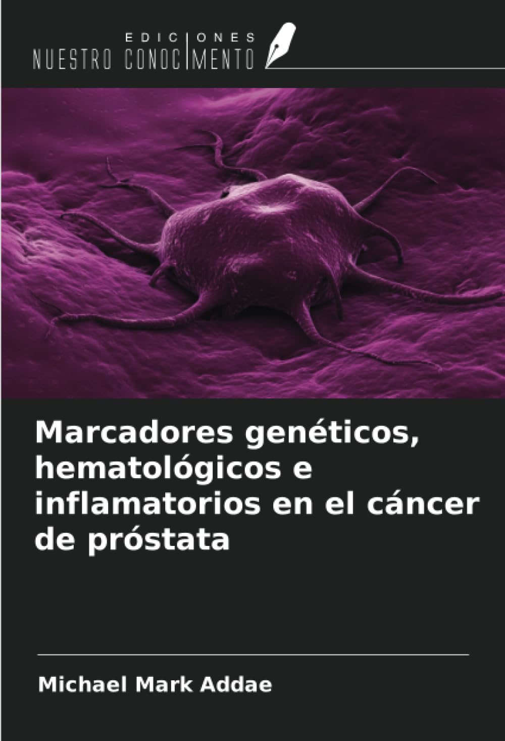 Marcadores genéticos, hematológicos e inflamatorios en el cáncer de próstata Medicine