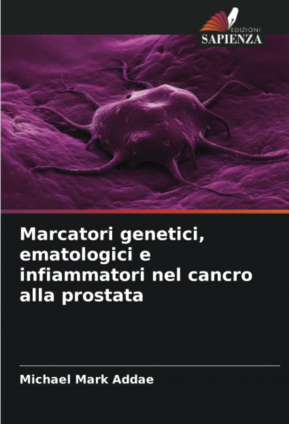 Marcatori genetici, ematologici e infiammatori nel cancro alla prostata Medicine