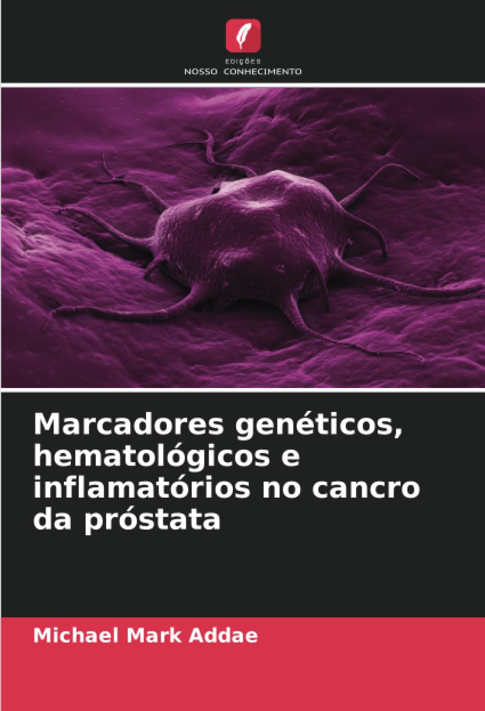 Marcadores genéticos, hematológicos e inflamatórios no cancro da próstata Medicine