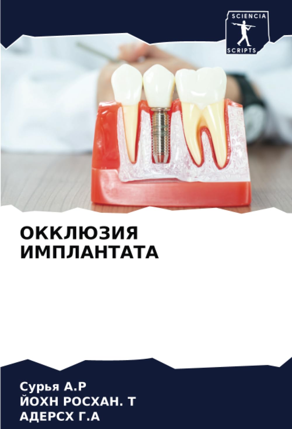 OKKLJuZIYa IMPLANTATA Medicine